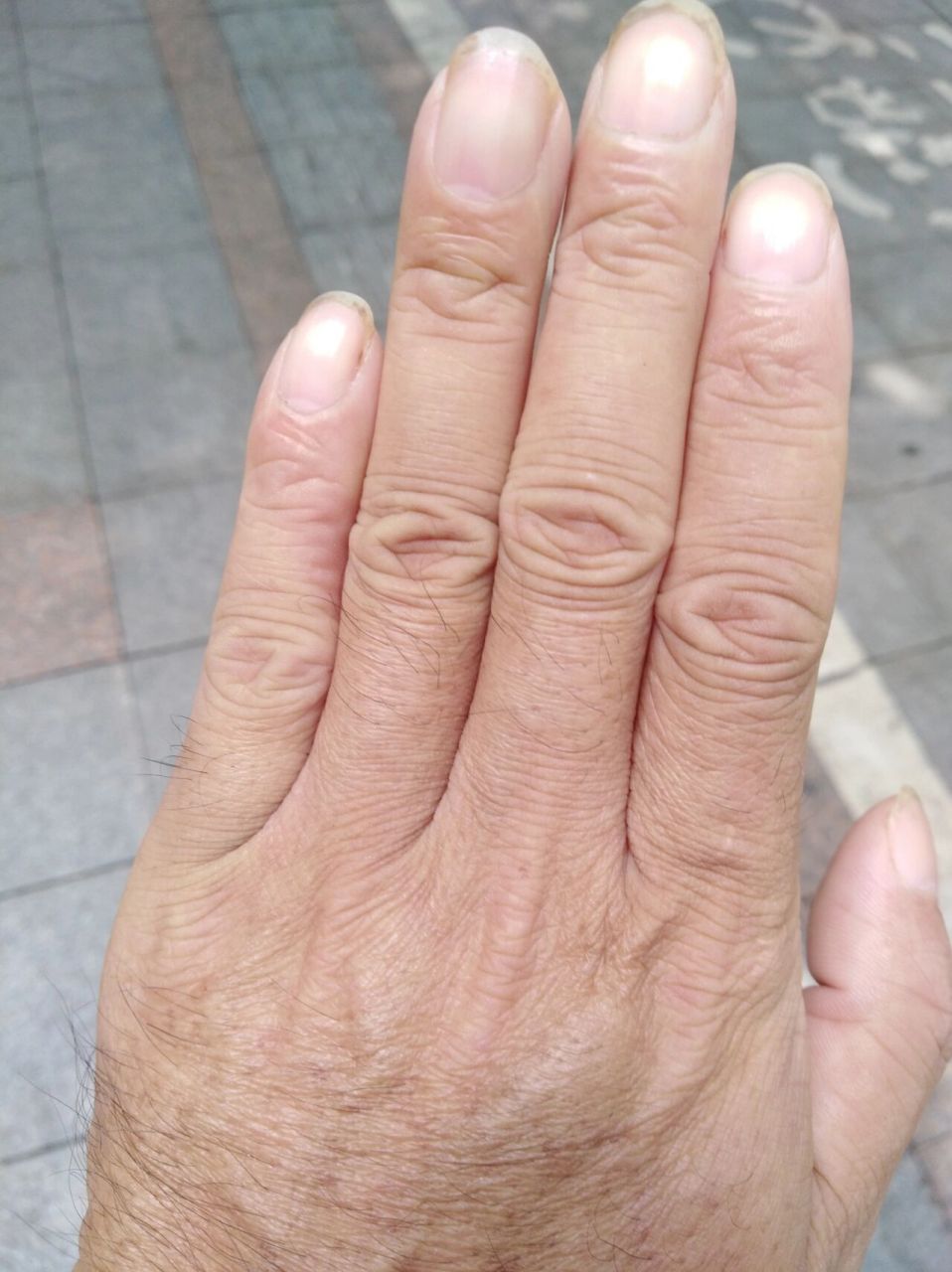 老人手皮肤也可以改变现在只剩下指关节皱纹 老人手的皮肤也是可以