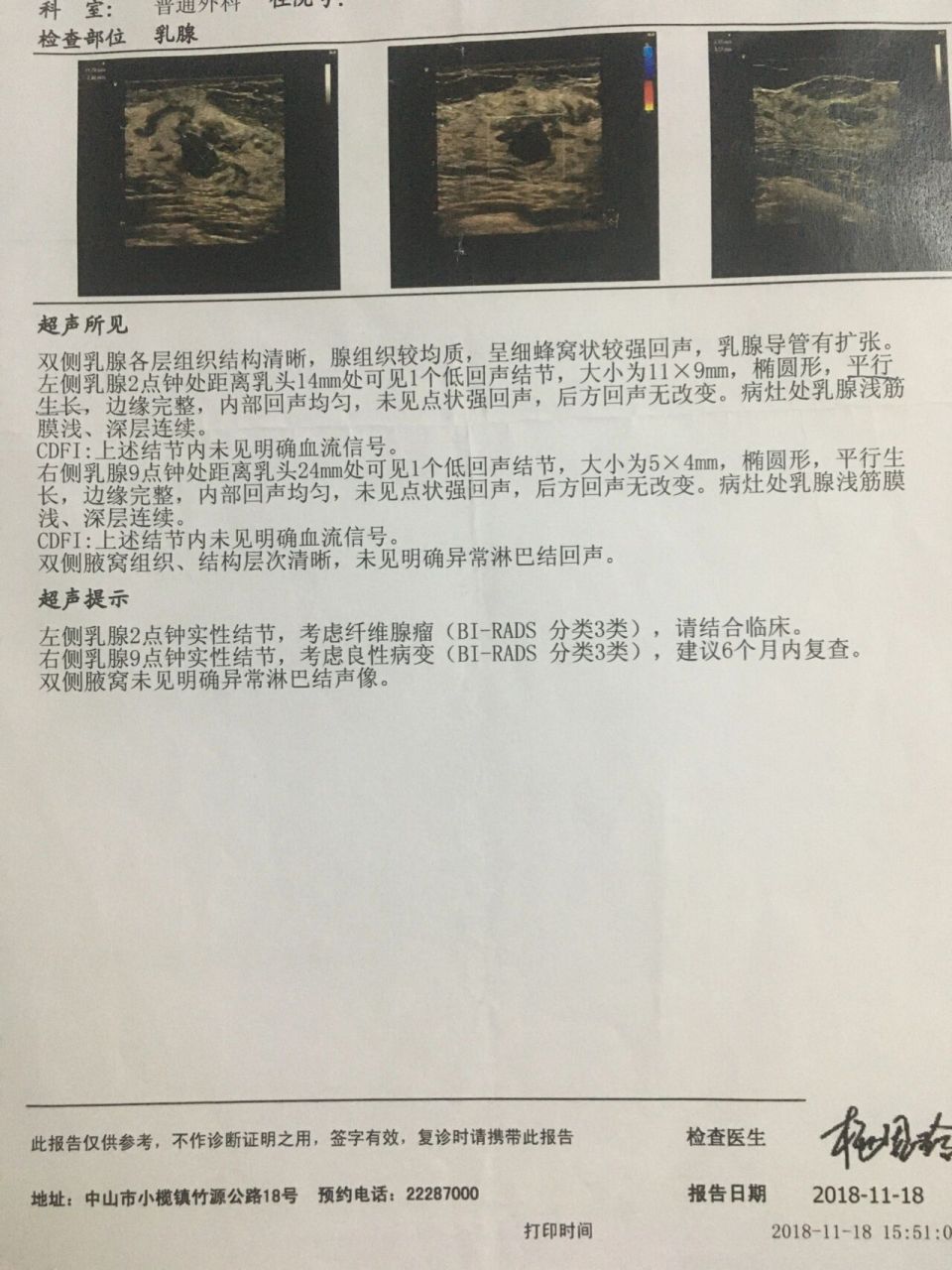 卵巢纤维瘤超声图片图片