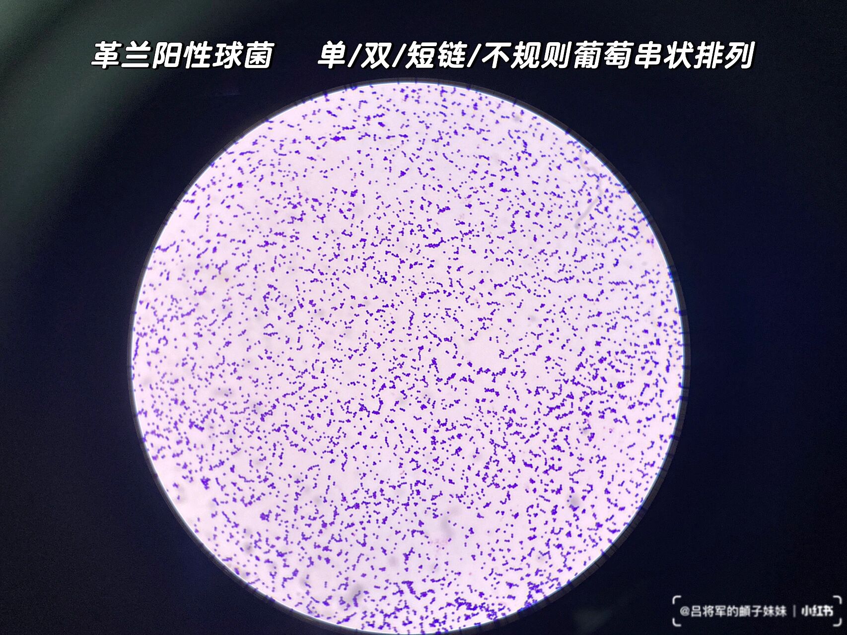 金黄色葡萄球菌 16615形态:革兰阳性球菌,直径0.5～1.