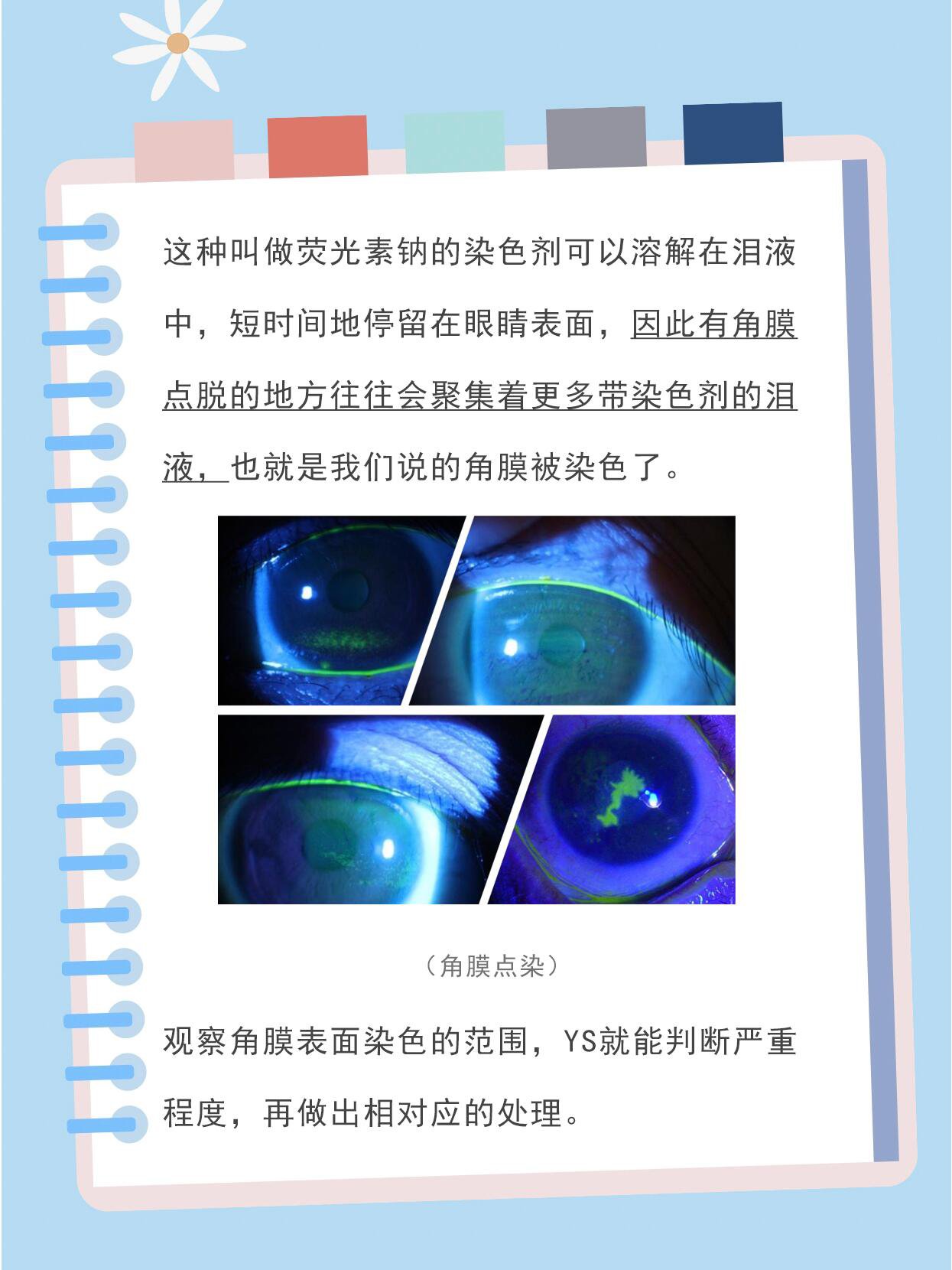 虚惊一场的角膜脱落 常有一些家长来门诊时很着急地说,ys,我家小孩的