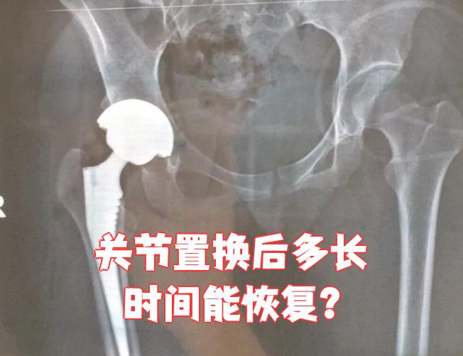 301医院代诊挂号服务康复训练专业指导，恢复效果更佳的简单介绍