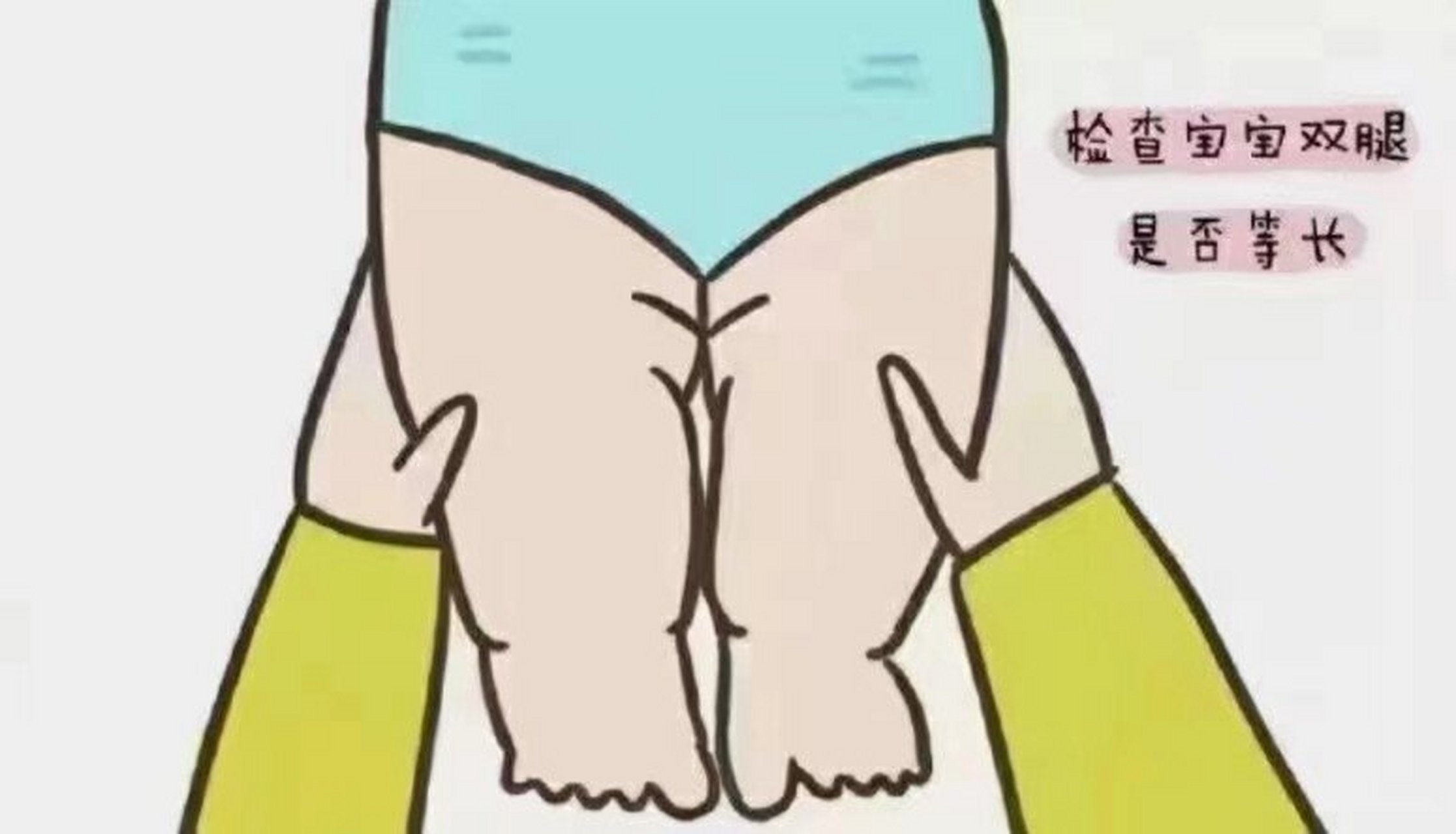 髋关节在家自测 宝宝太胖,腿纹不对称,妈妈就会觉得宝宝是不是髋关节