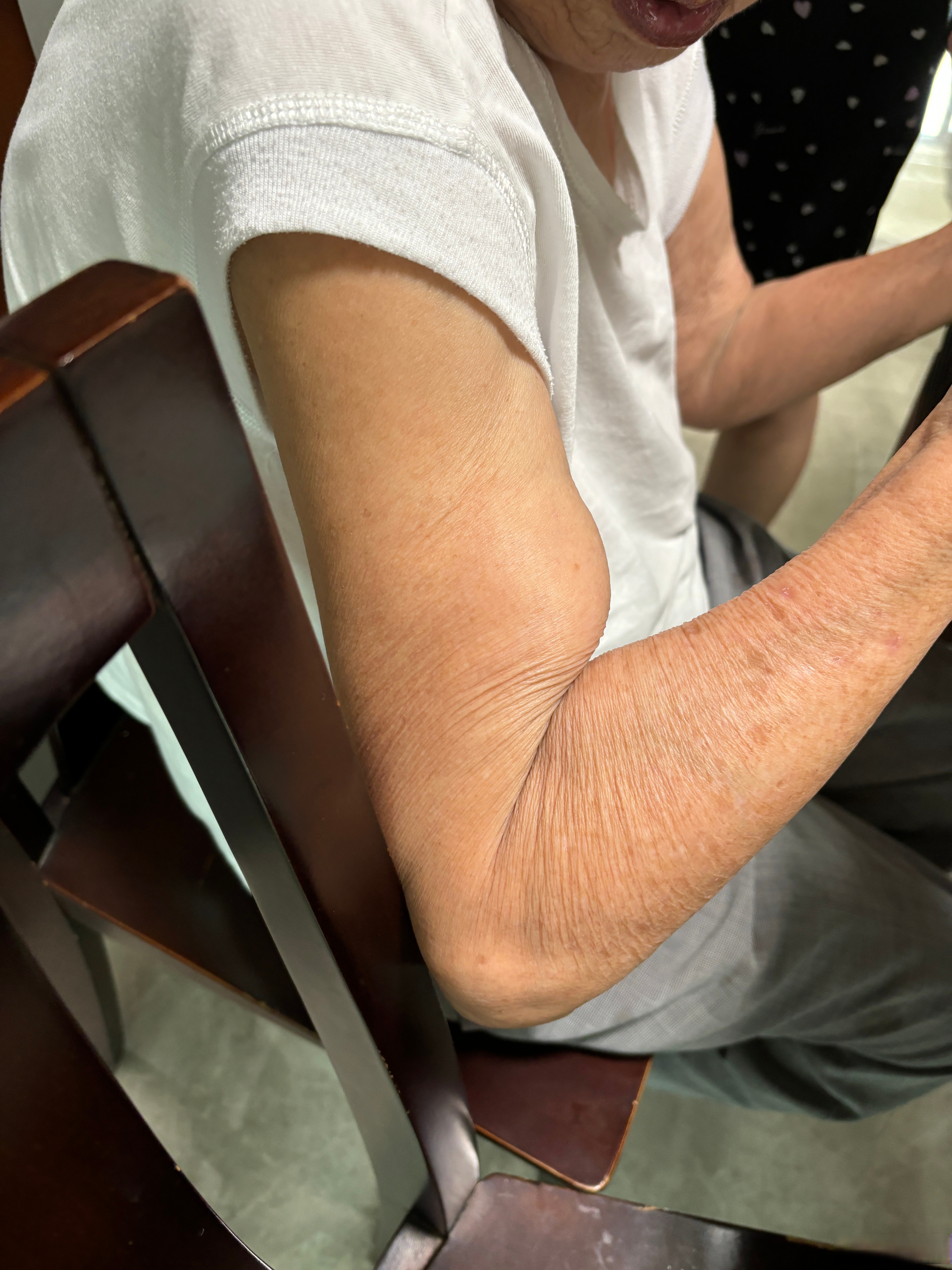 85岁外婆手臂 二头天赋原来是遗传 长沙顺收