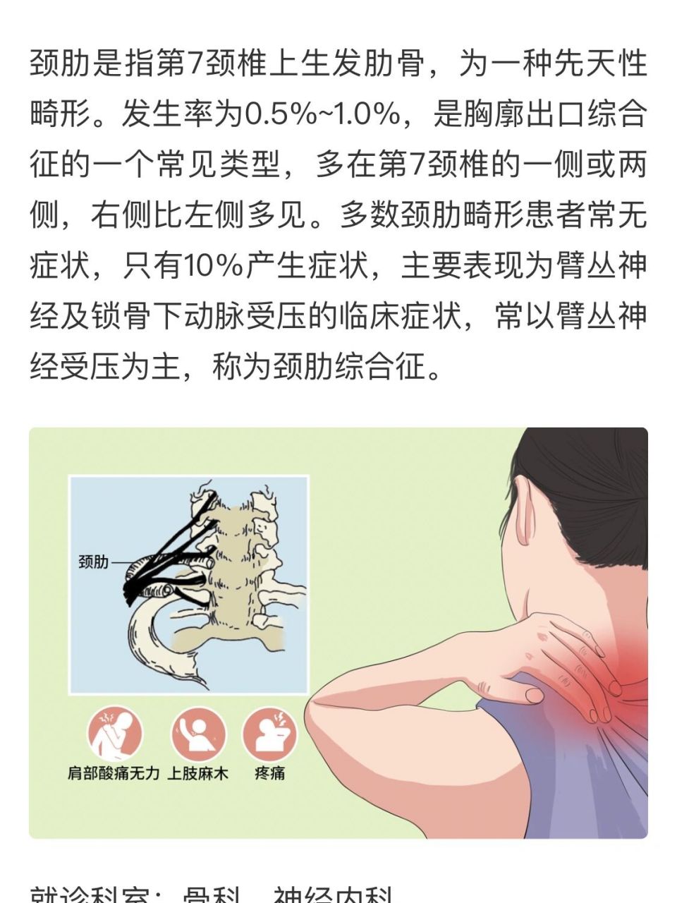 想知道有颈肋(颈椎第七节横突过长)有症状的人你们在哪里?