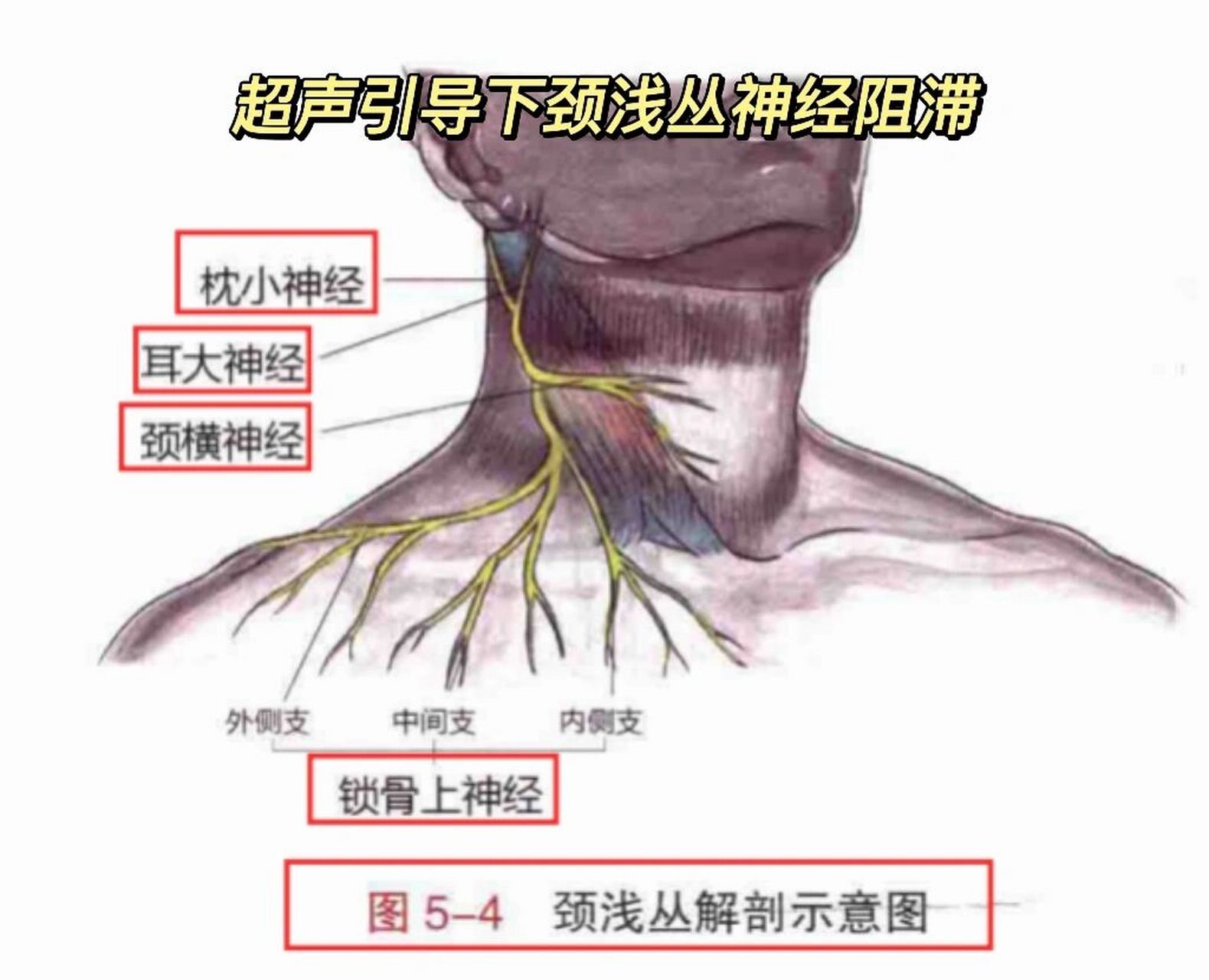 颈丛神经阻滞麻醉定位图片