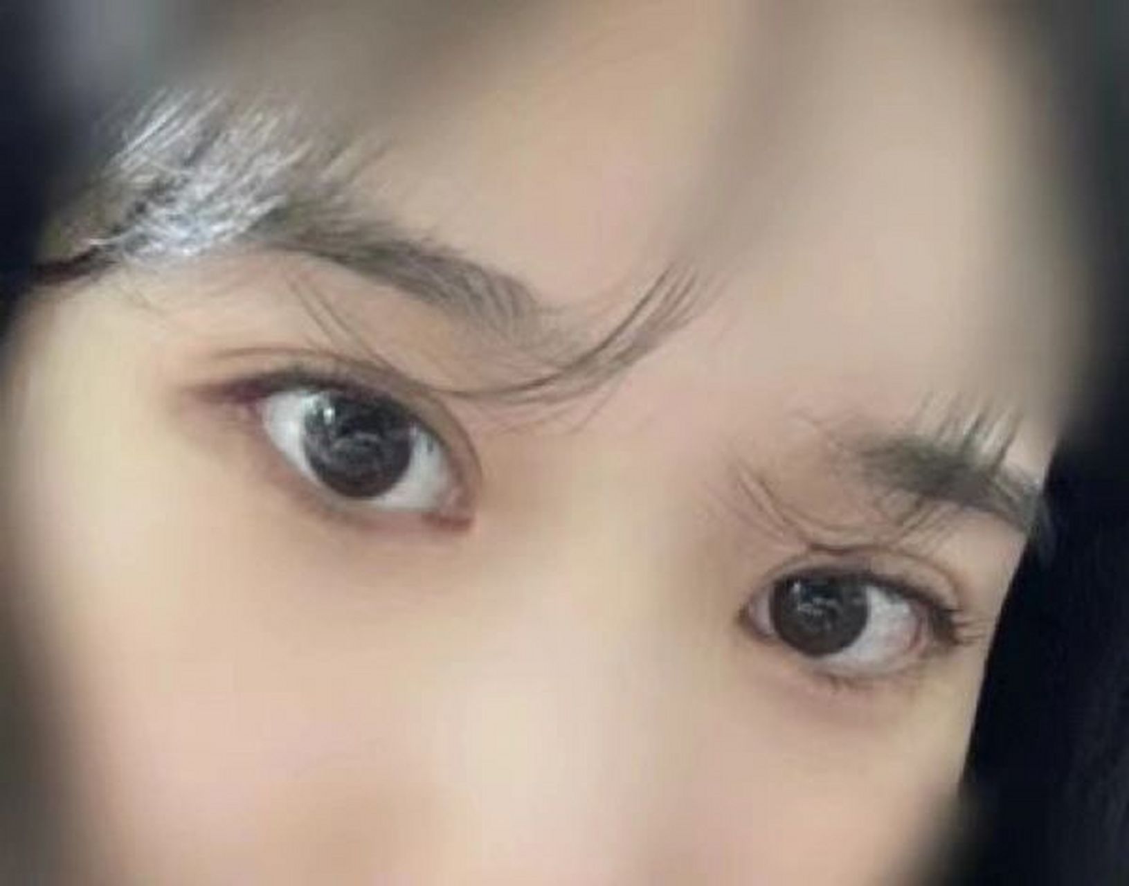 南京双眼皮 果然平扇没有选错 我本来喜欢开扇,但医生建议我试试平扇