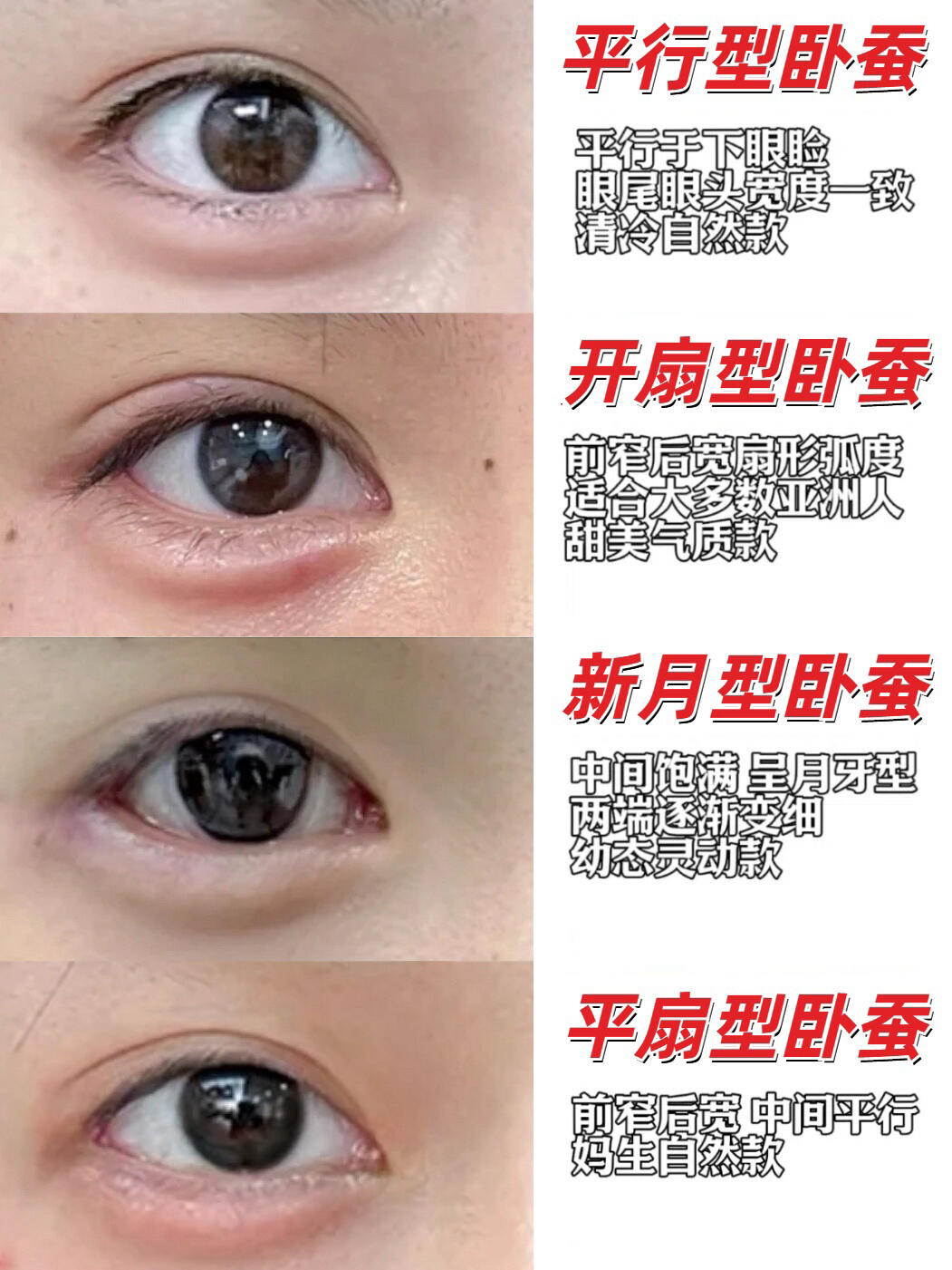 4种卧蚕形态,哪款是你的理想型