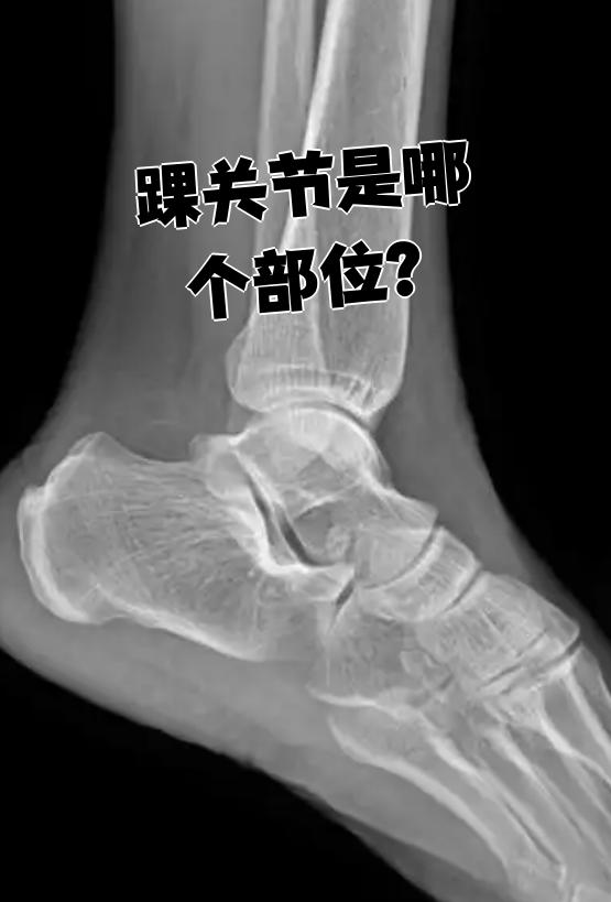 踝关节也叫距小腿关节,它是由胫骨,腓骨下端和距骨滑车组成的