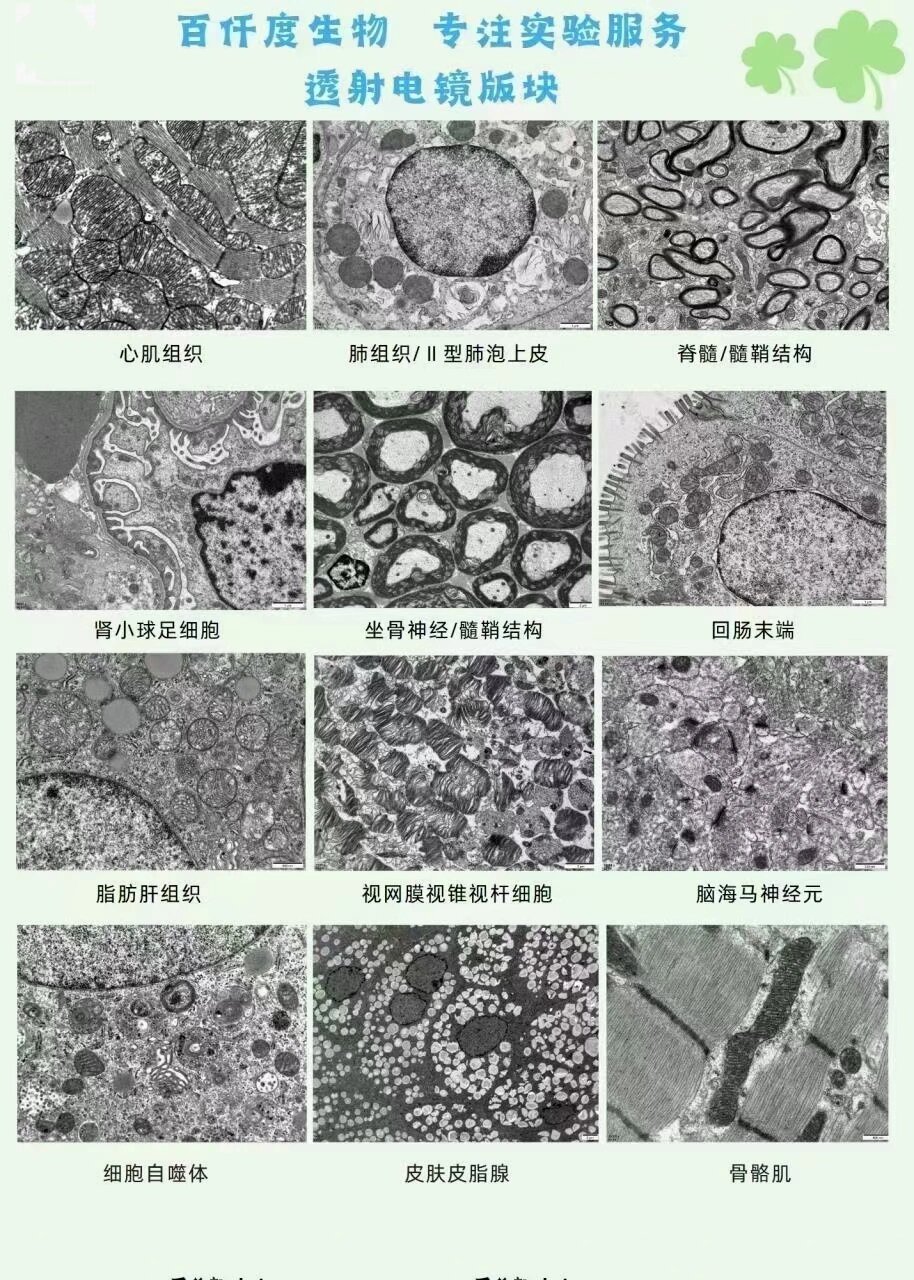 细胞核电镜图图片