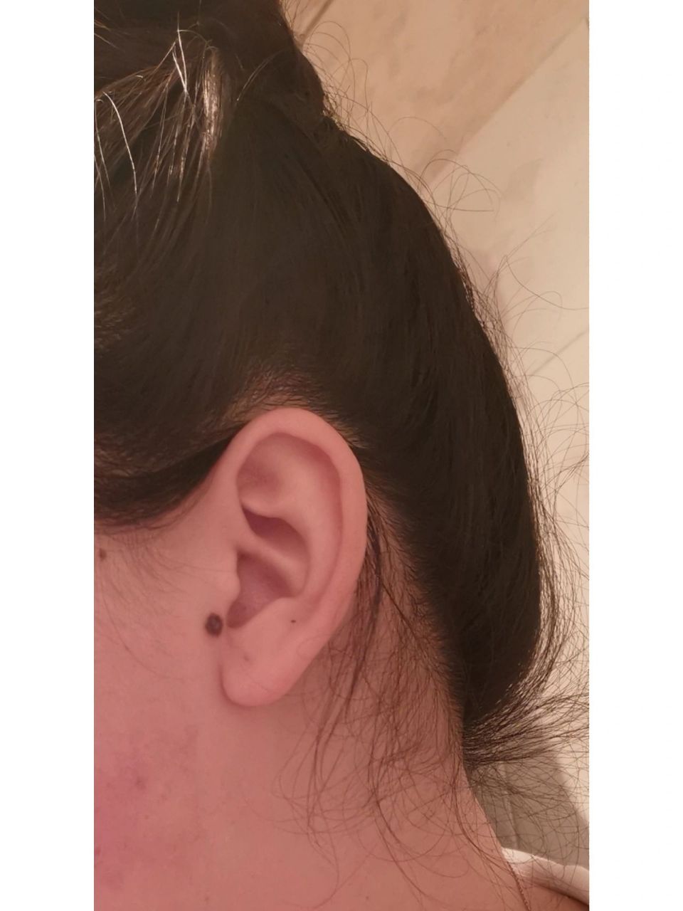 耳朵前痣,是好是坏