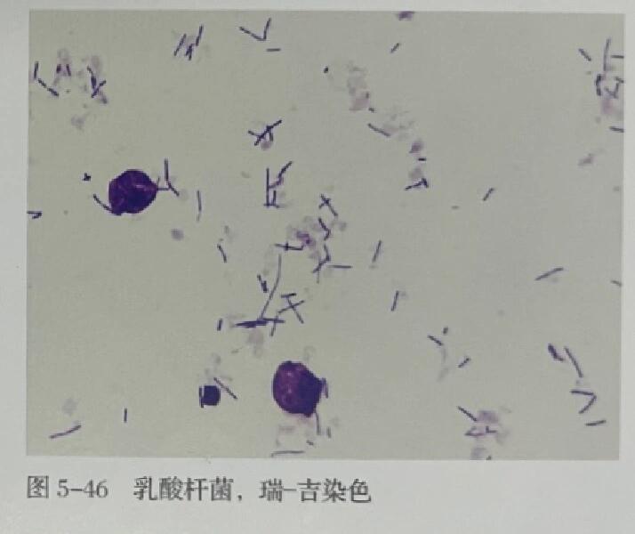 白带镜下乳酸杆菌形态