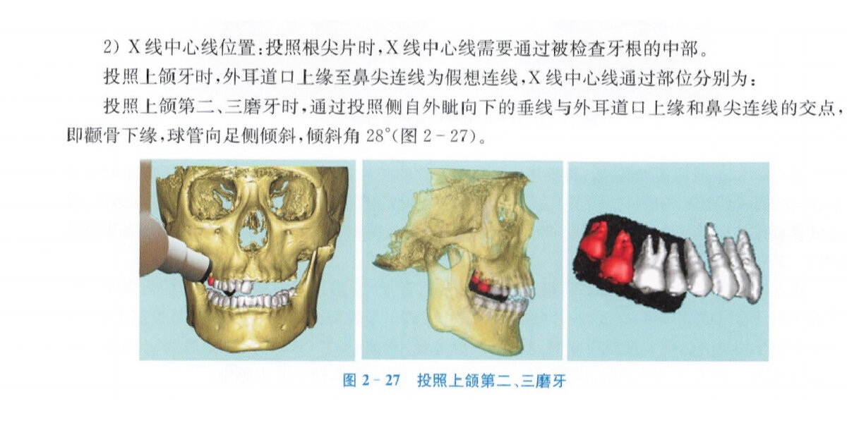 小牙片拍摄上颌牙齿投照角度图谱