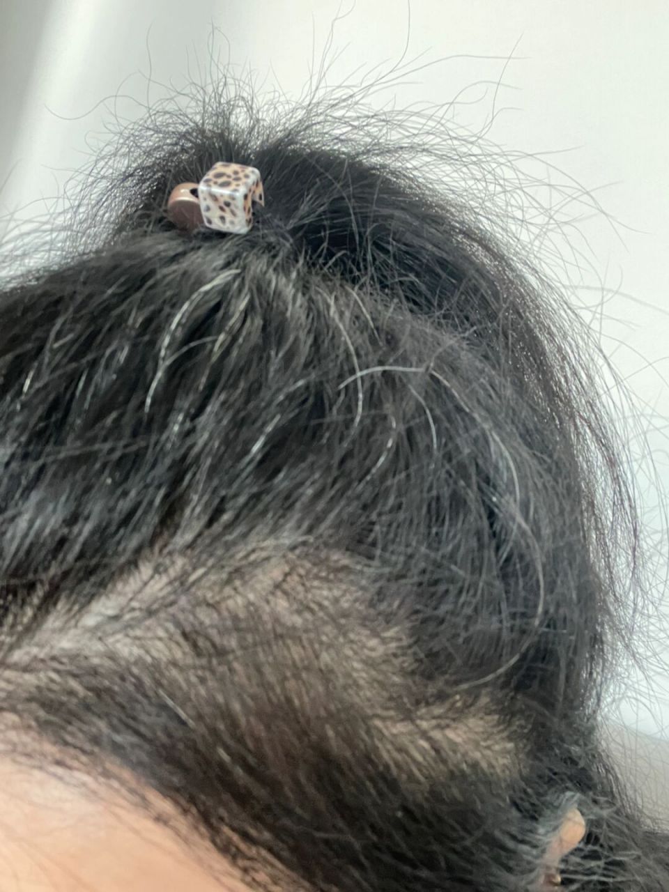 头发毛躁,头顶半截断发,怎么办,有什么好的方法.