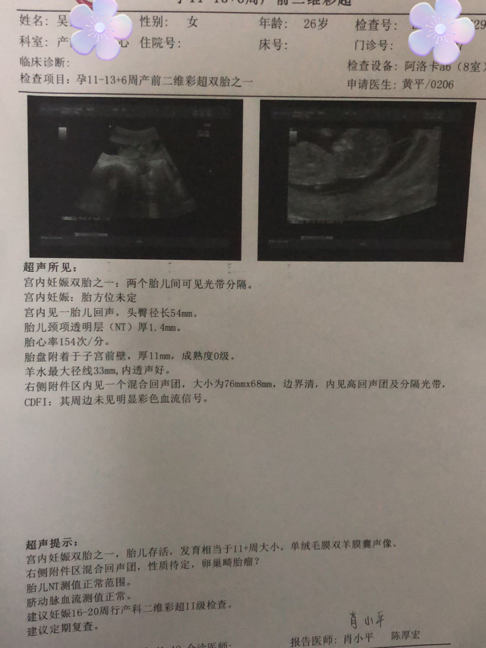 双胎发现畸胎瘤的我是安全怎么渡过孕期的 都怪自己大意了,几年前就