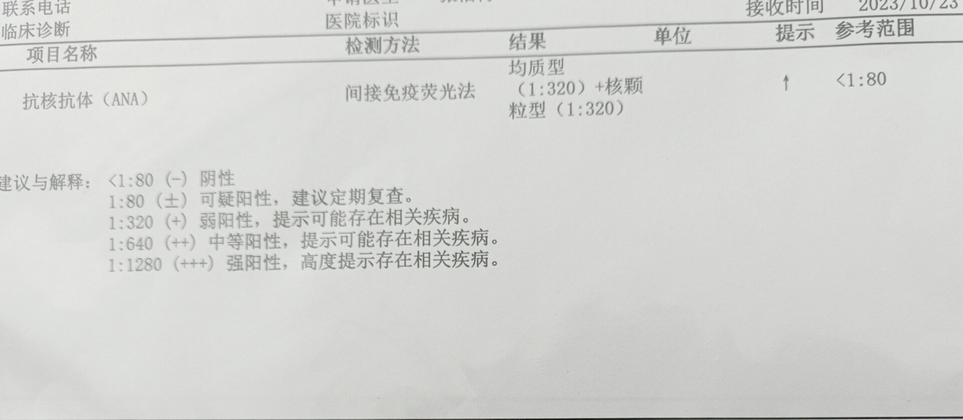 33周抗核抗体阳性1:320,d2聚体1