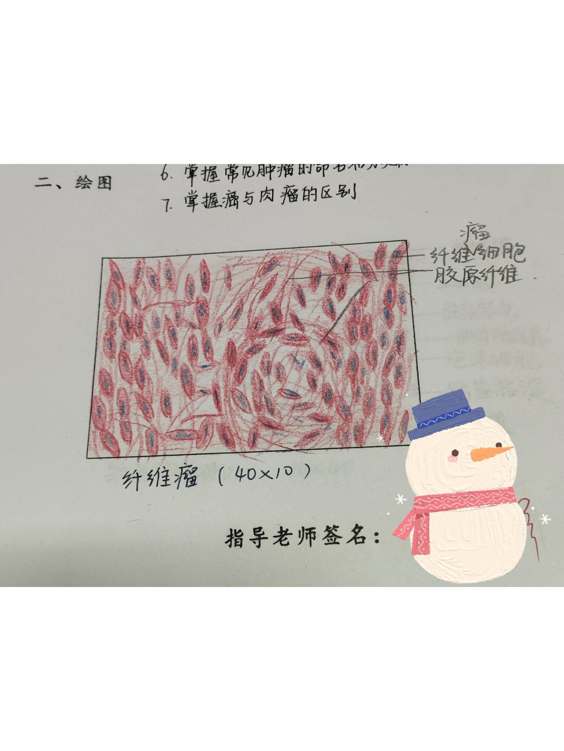 纤维瘤红蓝铅笔