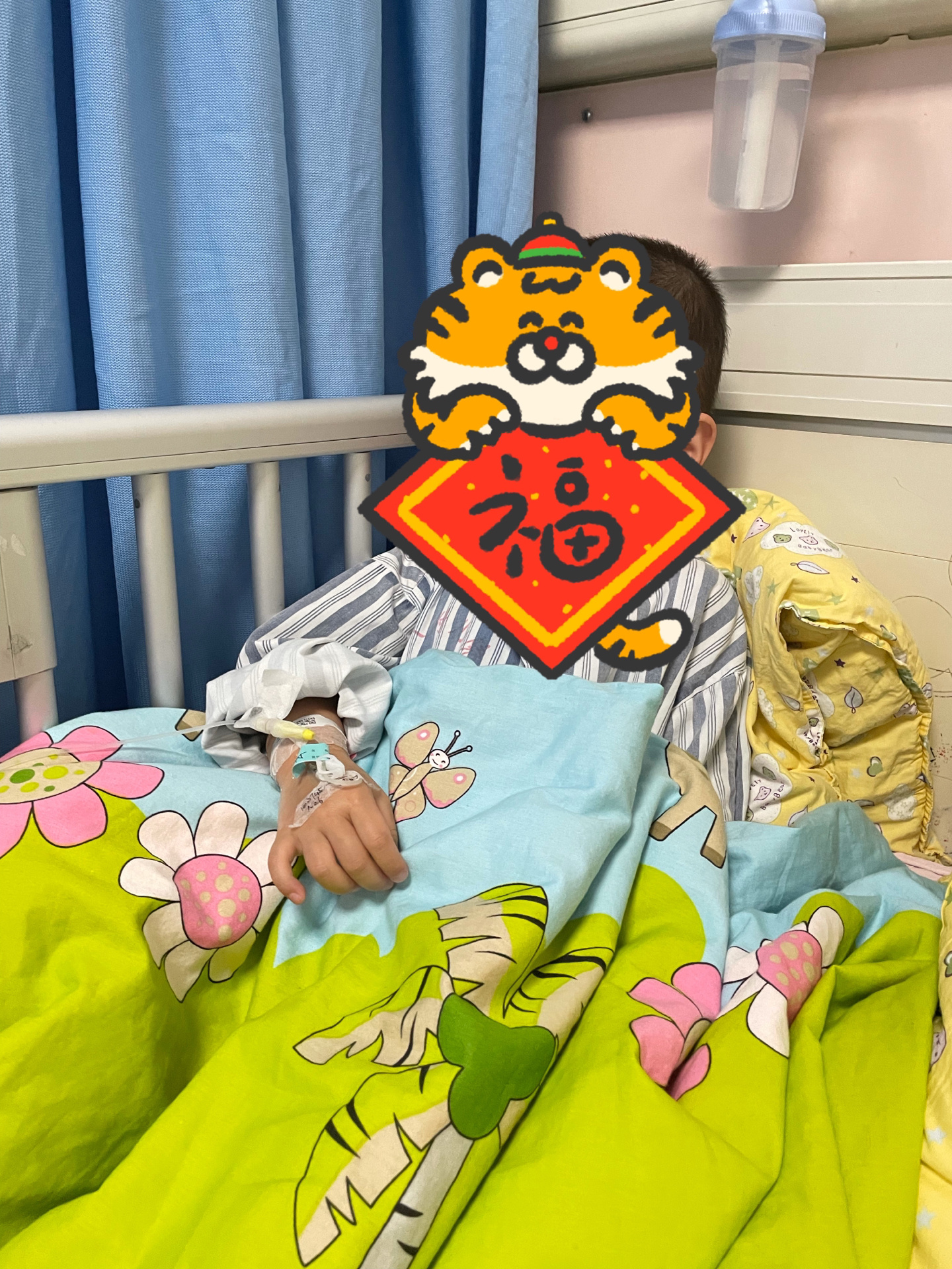 苏大附属儿童医院鞘膜积液手术 宝宝在14个月左右突然发现他右侧睾丸