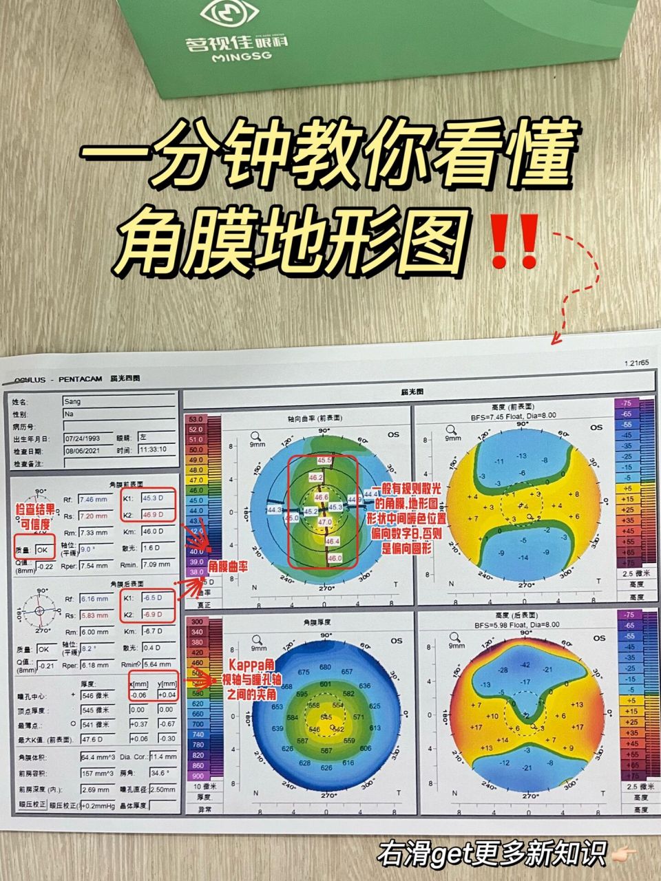 教你一分钟学会看角膜地形图98 平时好多人私信小茗让我帮忙看报告