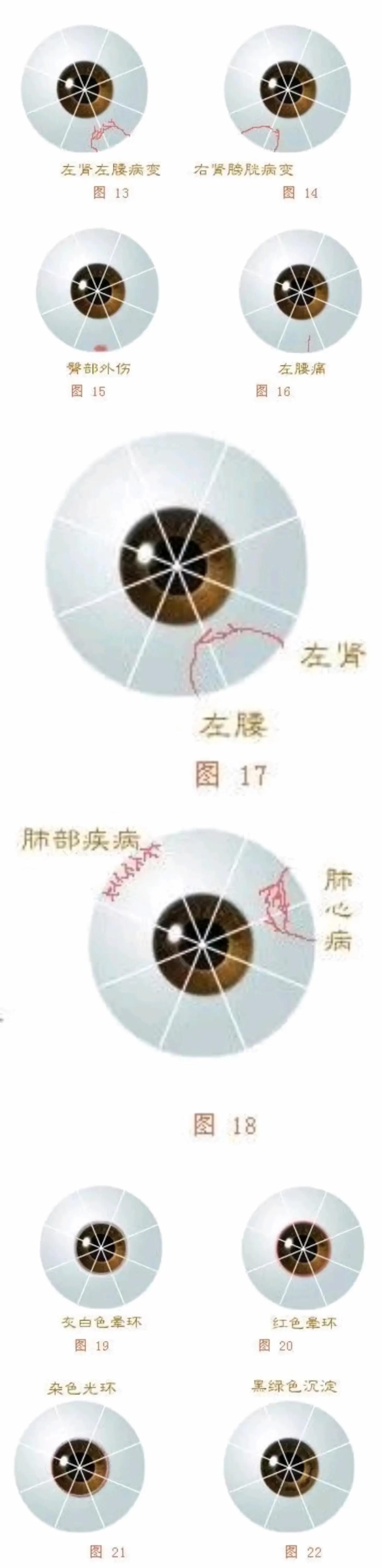 倪海厦讲眼诊图解图片