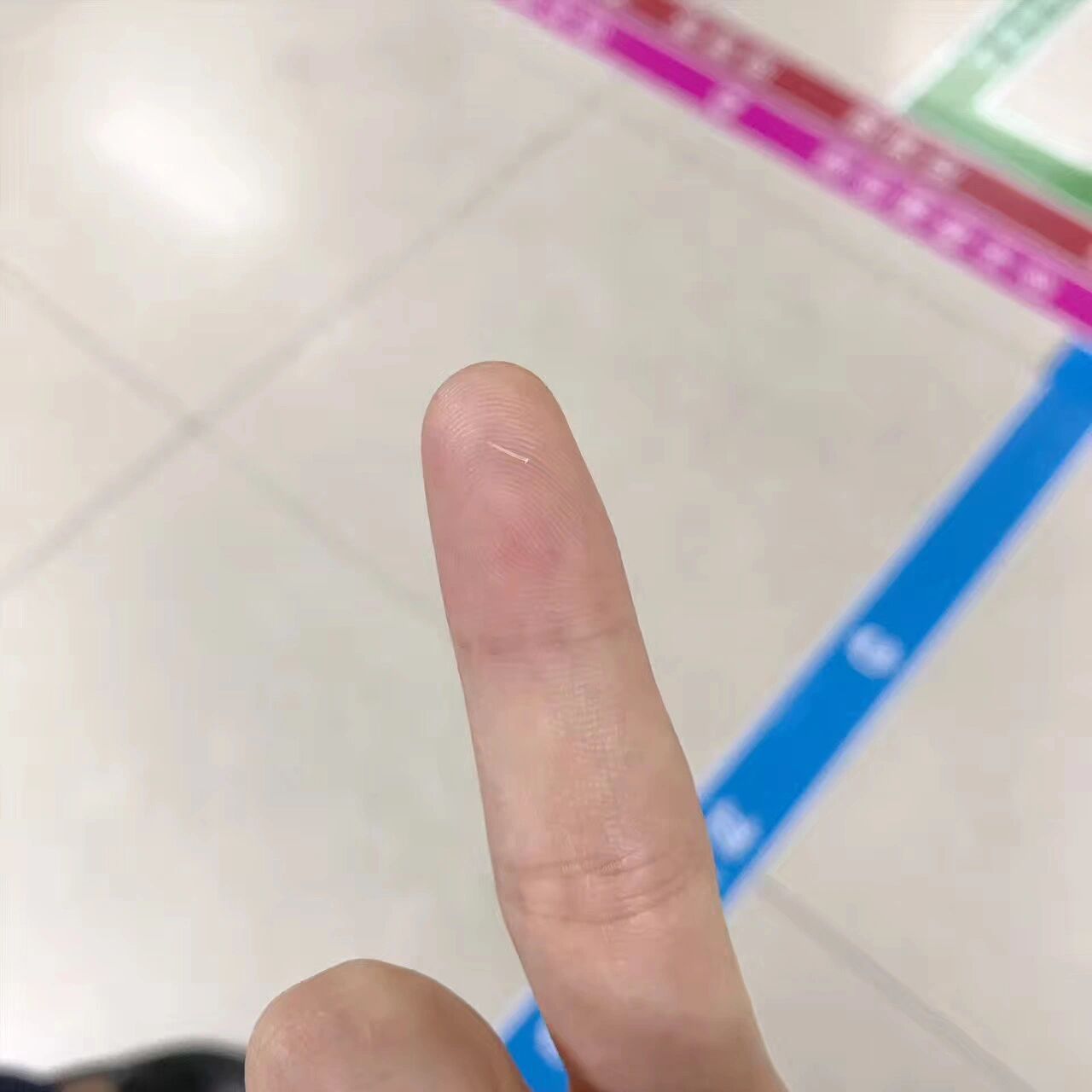 分享鱼刺卡喉咙-喉镜初体验 先说一下喉镜很快,一分钟就取出鱼刺,难受
