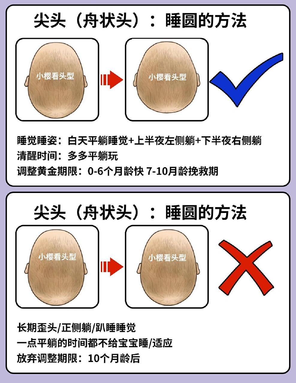 73简单清晰讲清楚宝宝头型如何睡出小圆头 尖头(舟状头)睡圆方法