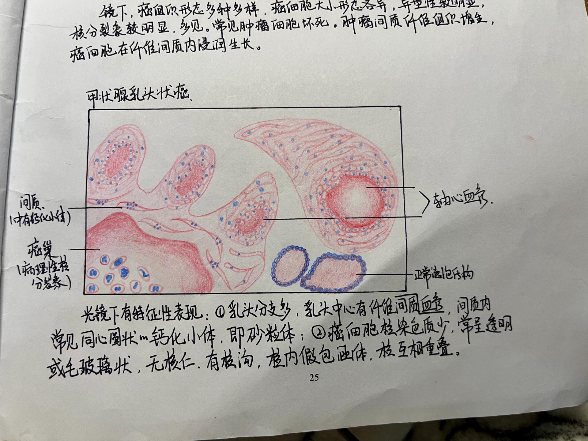 乳腺癌红蓝铅笔绘图图片