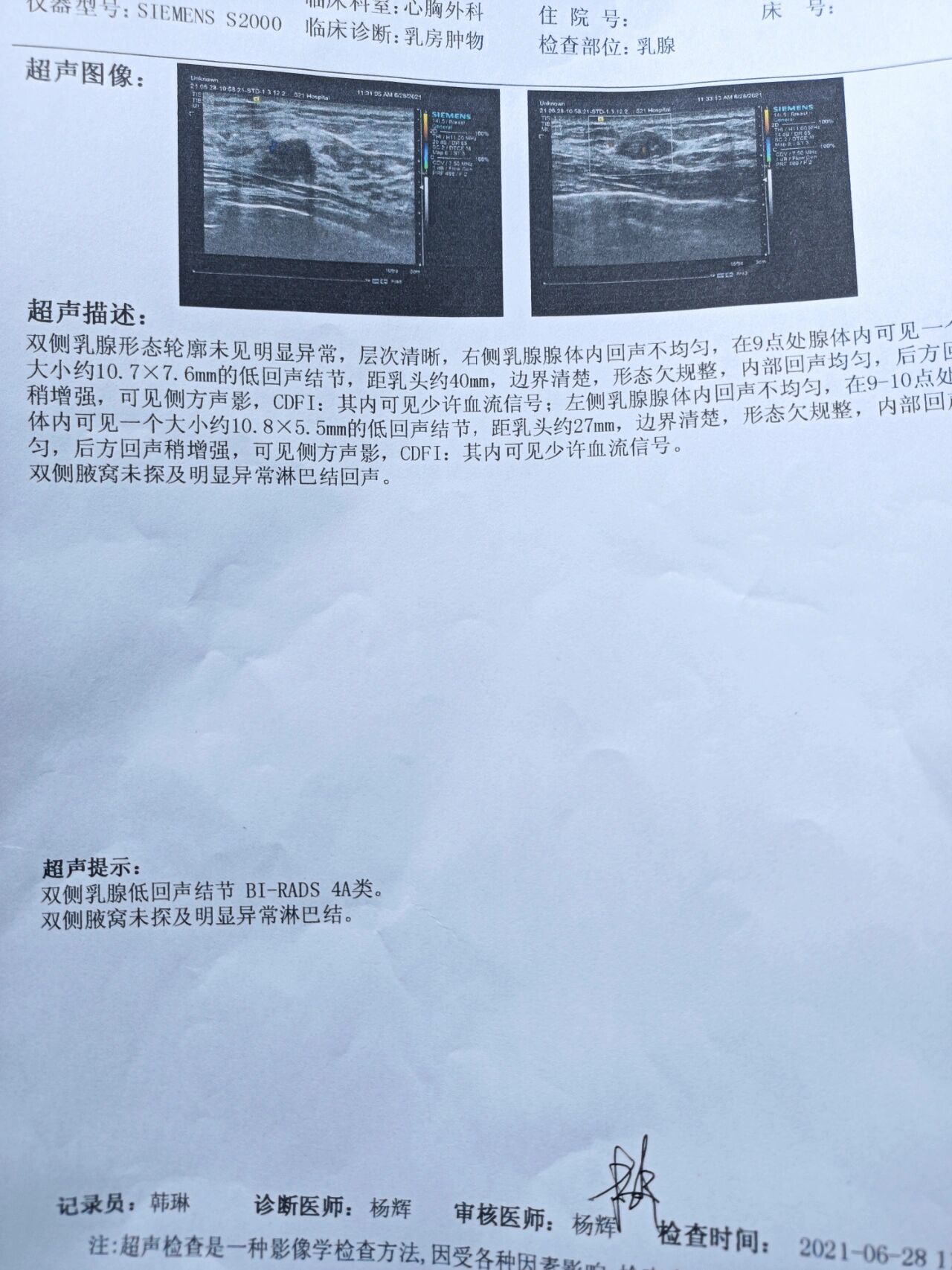 乳腺结节4a
