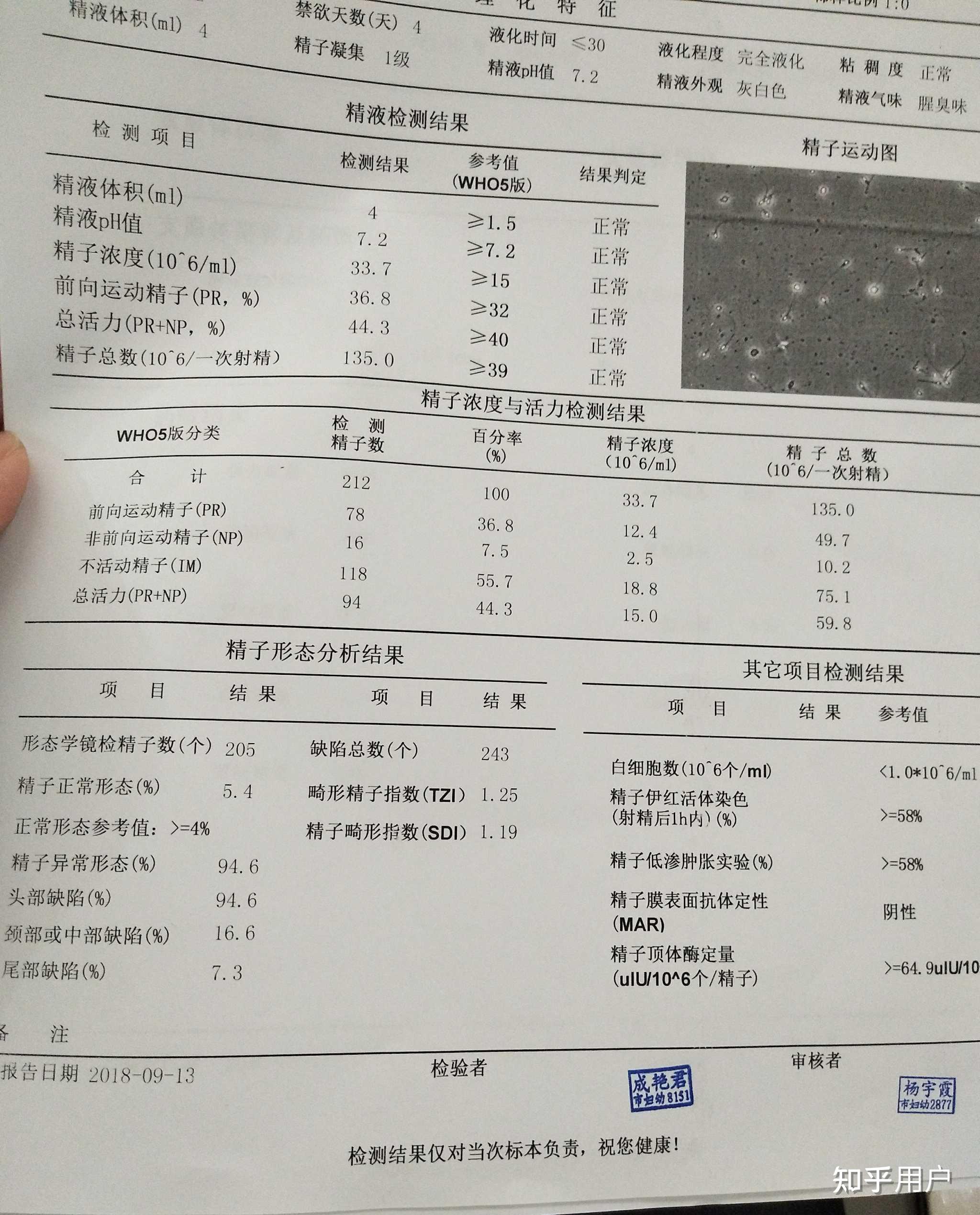 正常精子图片男人图片