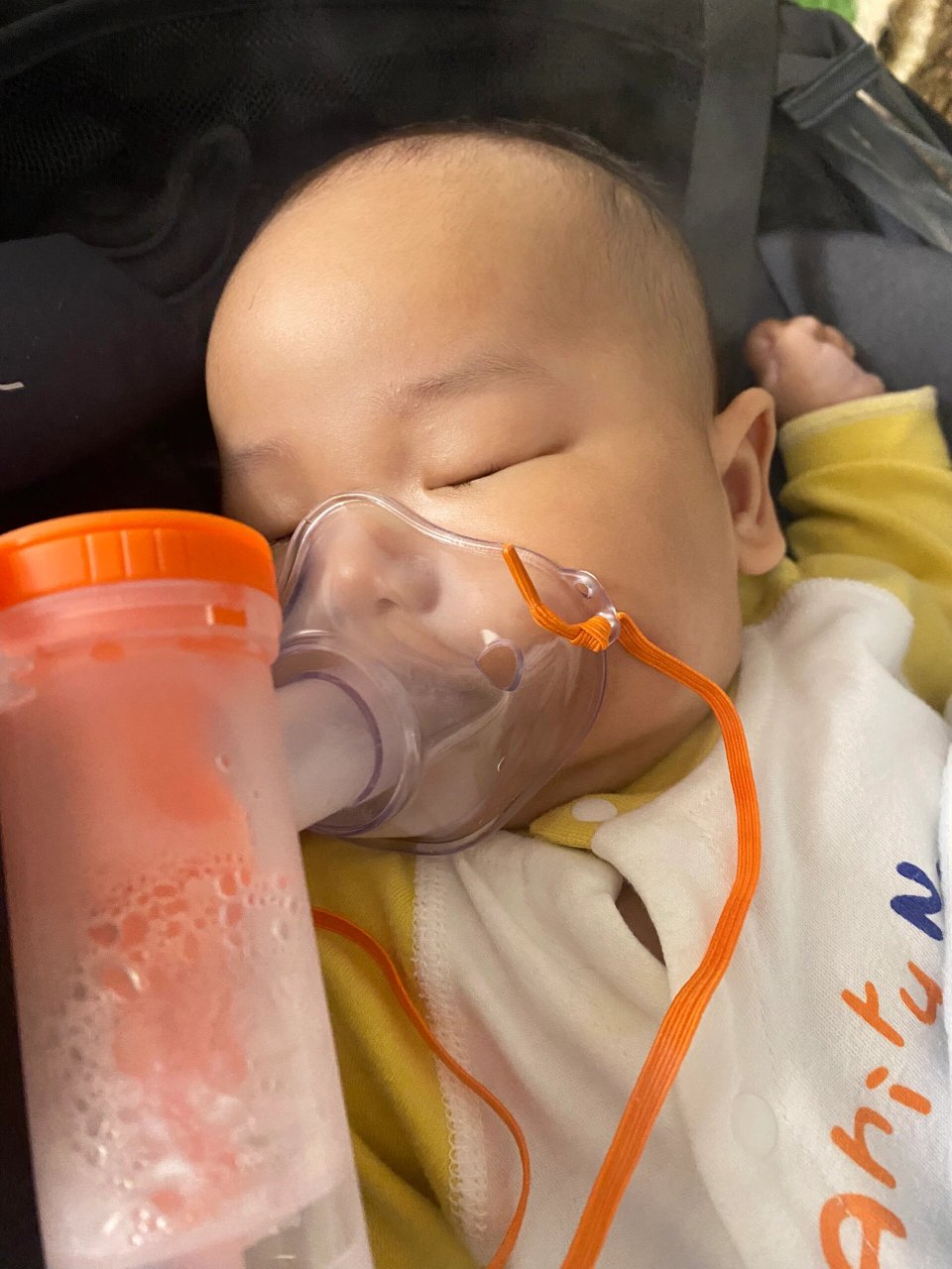 有好用的雾化器推荐吗 100天宝宝毛细血管支气管炎咳嗽,医生建议雾化