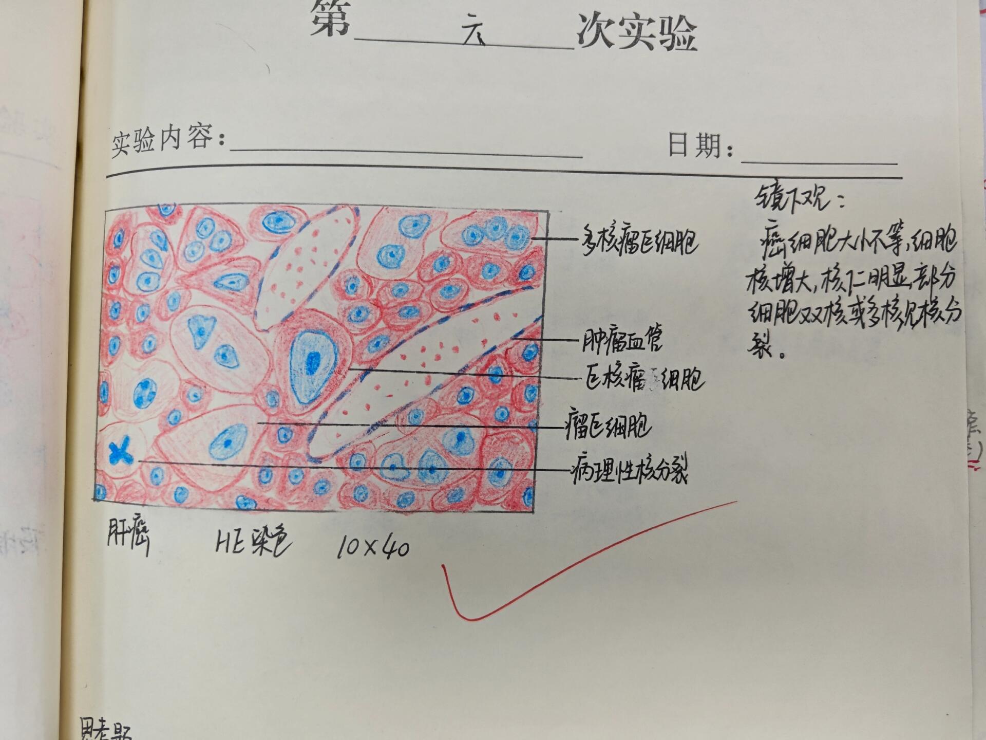 病理实验绘图 肝细胞水肿 肝细胞脂肪变 肉芽组织 肝淤血 慢性肺淤血