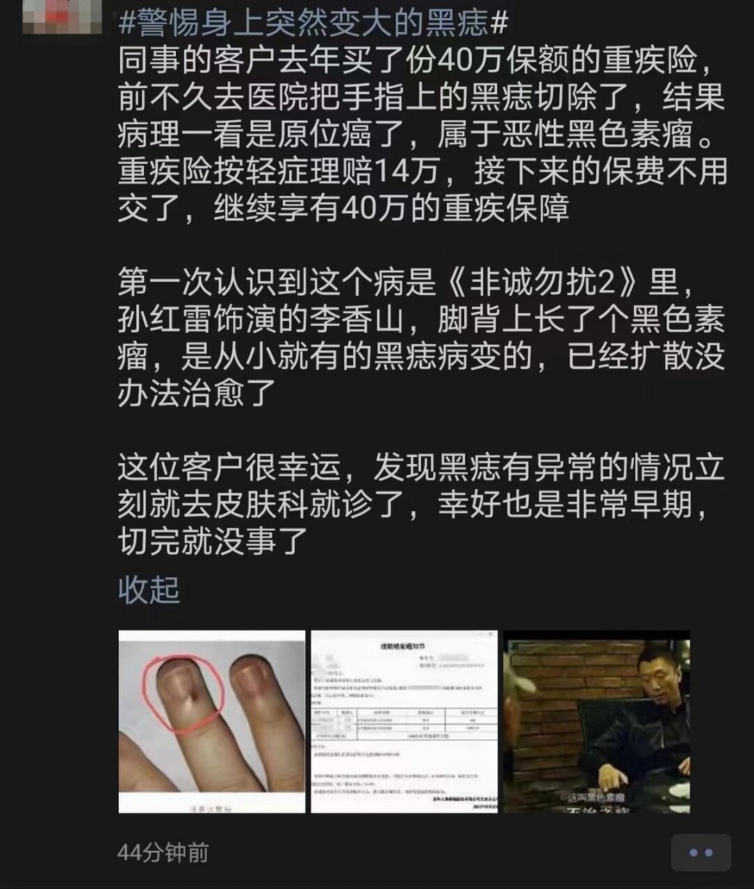 突出的黑色痣图片