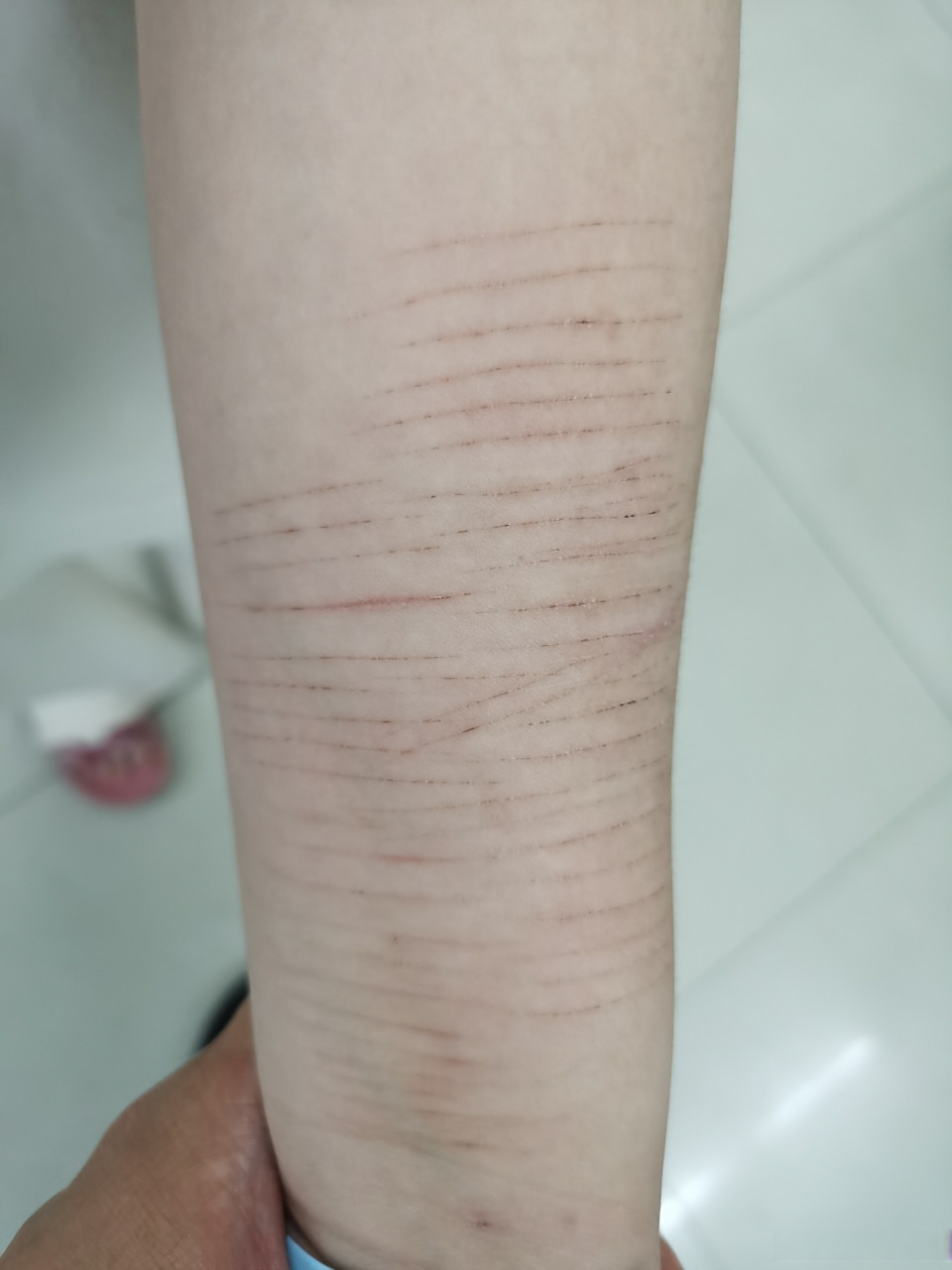 【青少年心理问题突出八九成有自残史 】近些年,来心理门诊看病的儿童