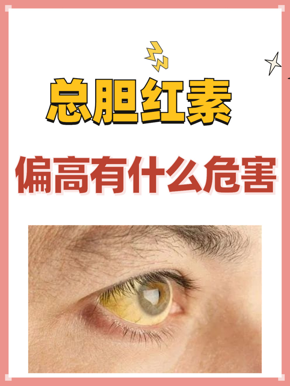 总胆红素偏高都有哪些危害? 1.