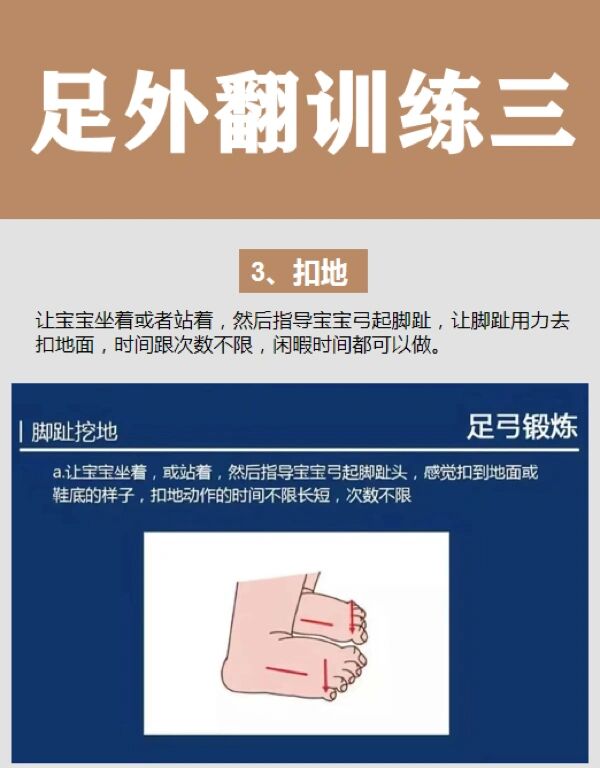 宝宝足外翻怎样矫正图片