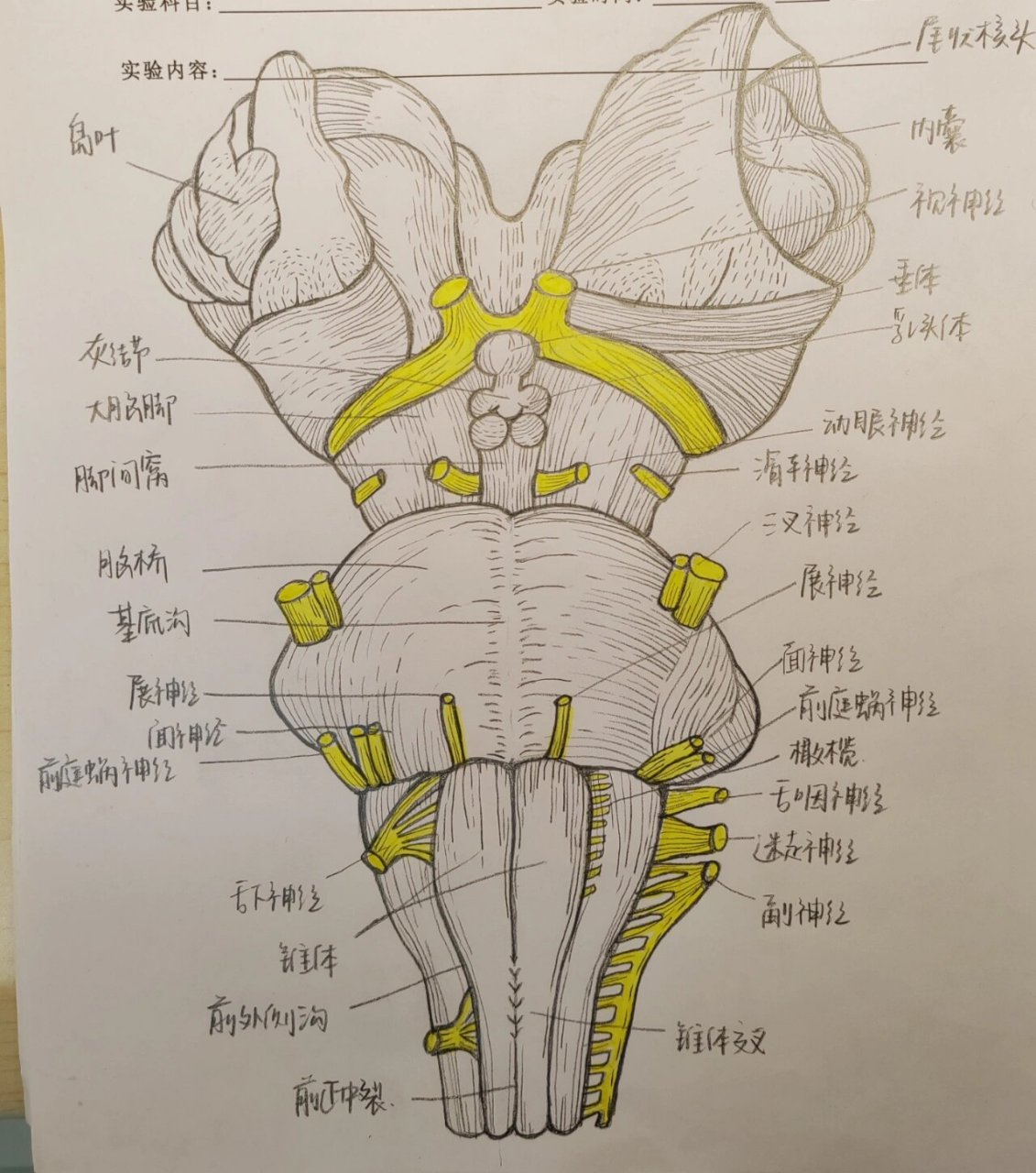 脑干腹侧面的结构图图片