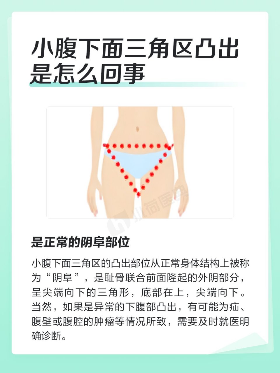 小腹下面三角区凸出是怎么回事 小腹下面三角区的凸出如图所示,可能是