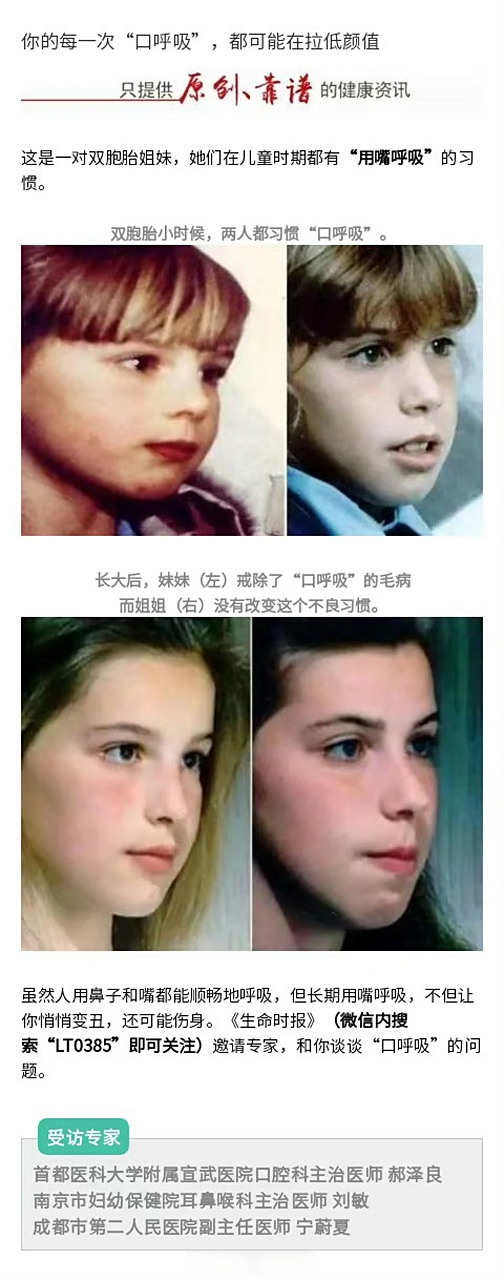 【#口呼吸不只是影响颜值# 】#腺样体面容# ,#长期口呼吸或会阻碍智力