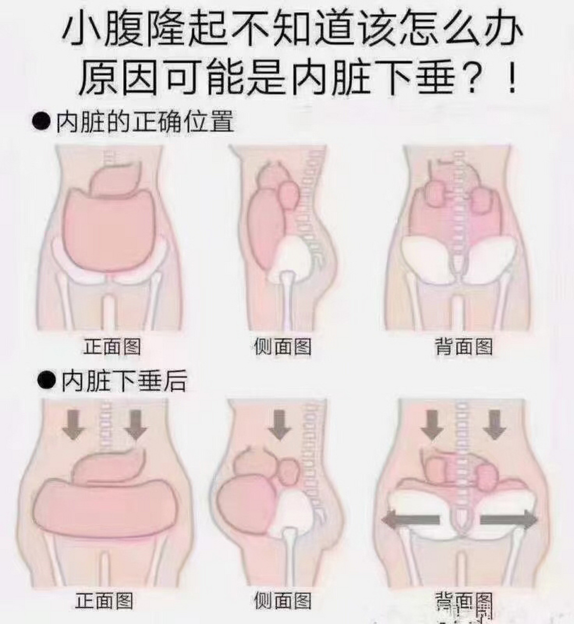 小腹突出不止是胖瘦问题-有可能是内脏下垂 95今天给大家解释一个