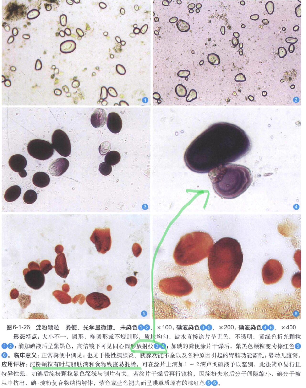 粪便常规镜检图片图片