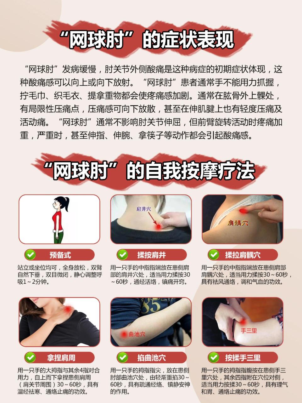 肘部酸痛谨防"网球肘" ■"网球肘"的症状表现99 "网球肘"9499