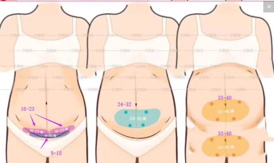 大家20周左右时,胎心在哪里?