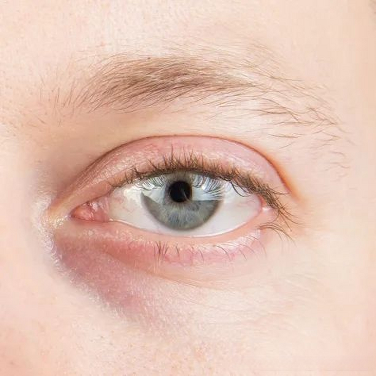 当然我填充的泪沟没有出现过这种情况.