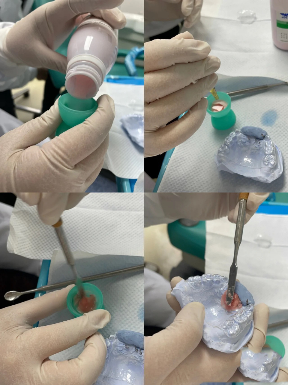 正畸必看之-双曲舌簧矫治器制作3 重新编辑,下载图片自动带logo