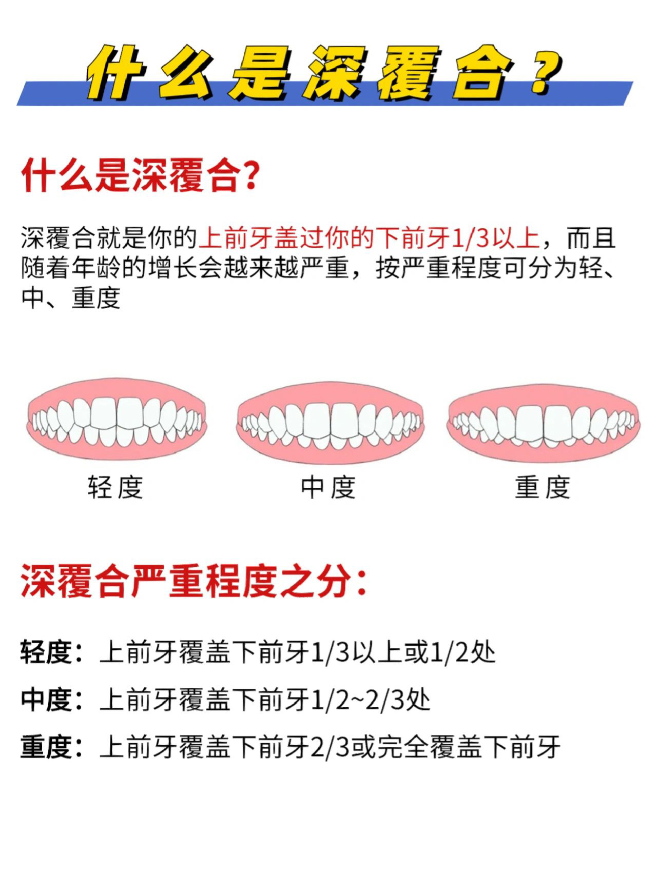 深覆合自我矫正方法图片