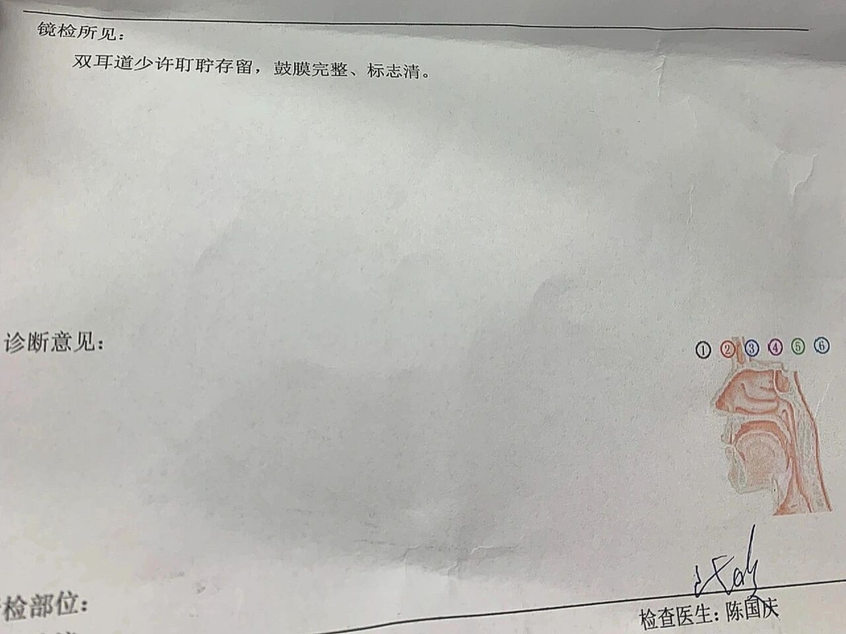 鼓膜穿孔小建议 耳膜穿孔一个多月了,现在长好了,来和大家分享一下