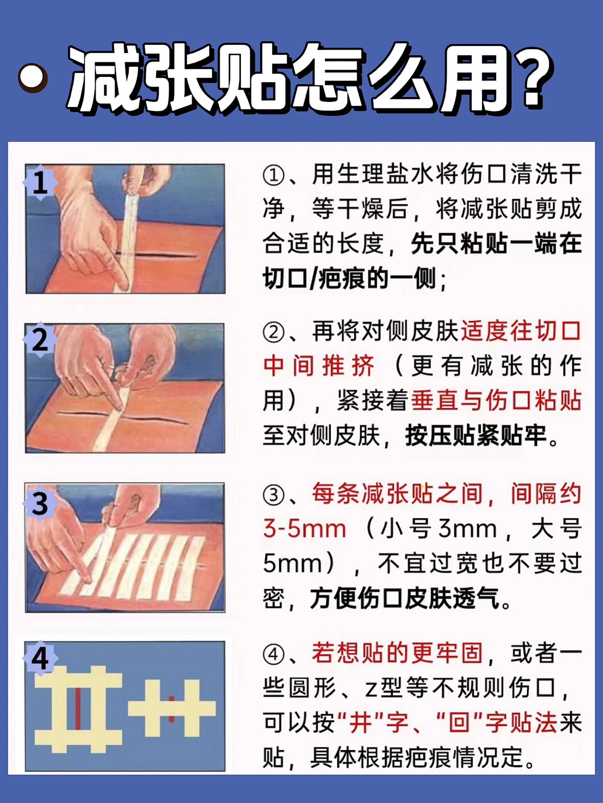 颞肌贴敷手术过程图解图片