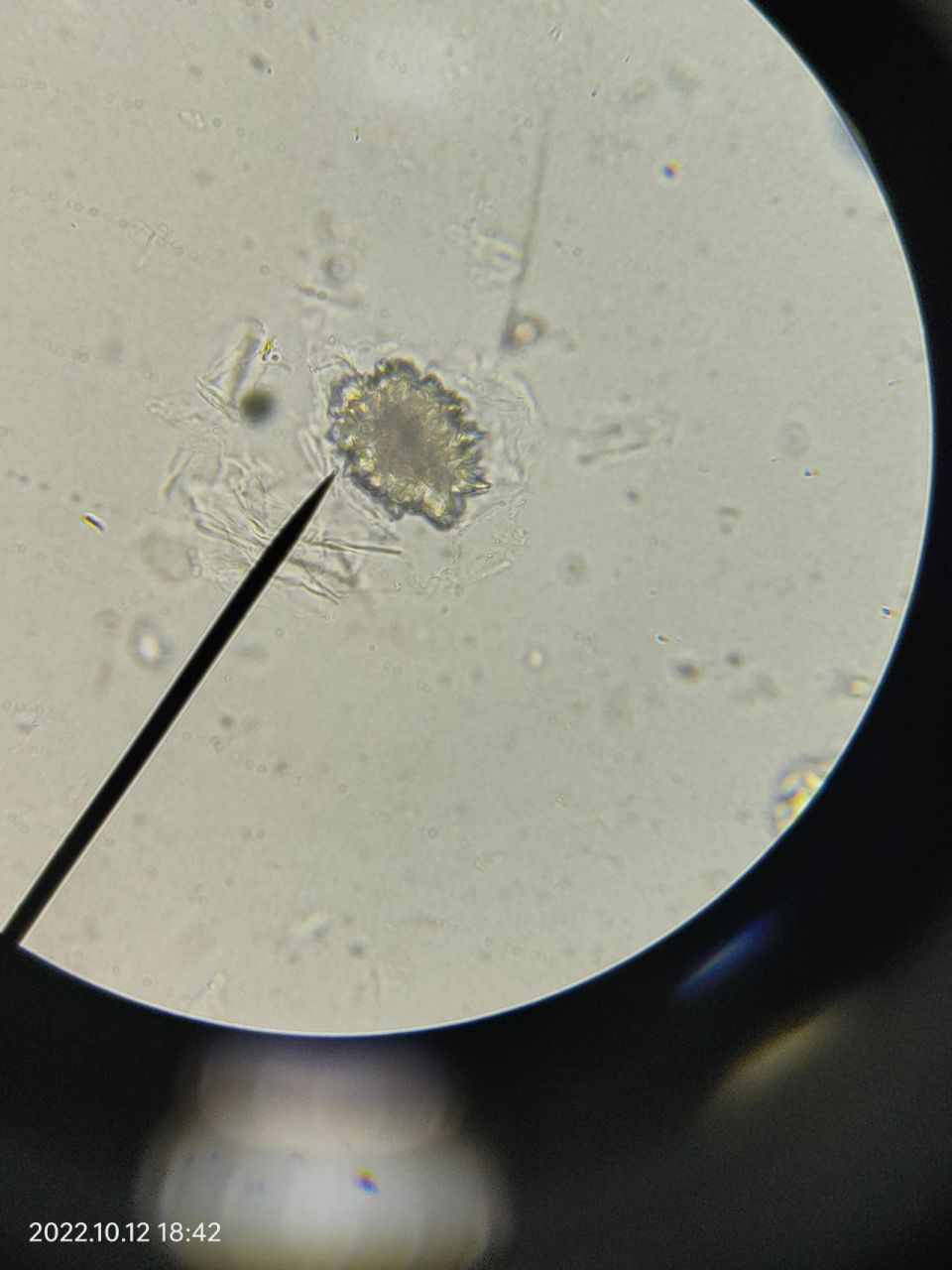 大黄粉末显微镜简图图片