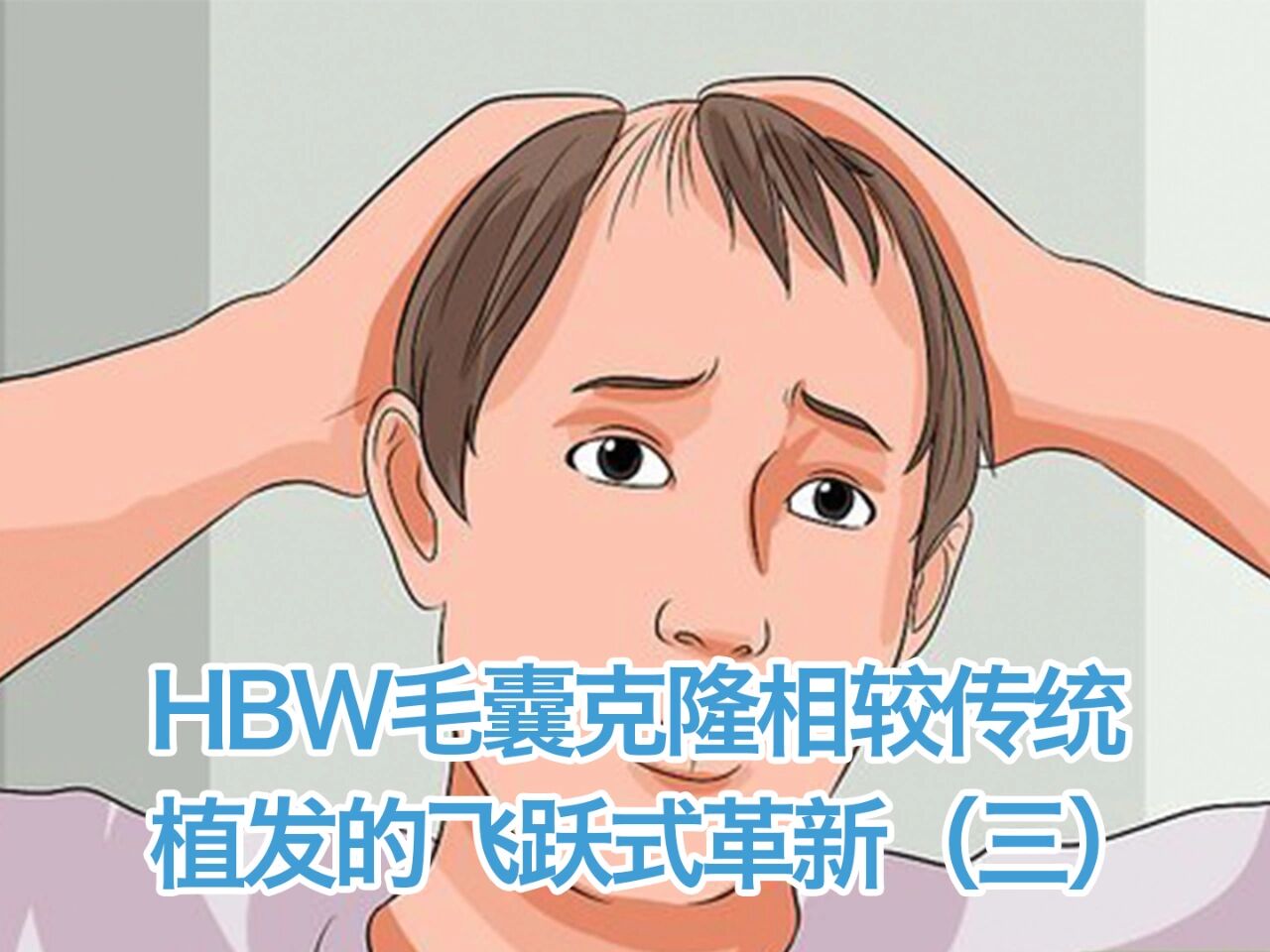 hbw毛囊克隆0恢复期无需剃发不影响形象