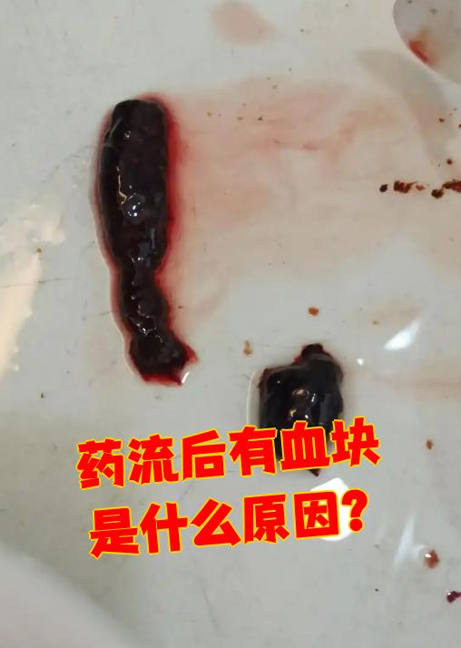 1.内分泌紊乱:药流会影响卵巢功能和激素水平,导致月经不规律