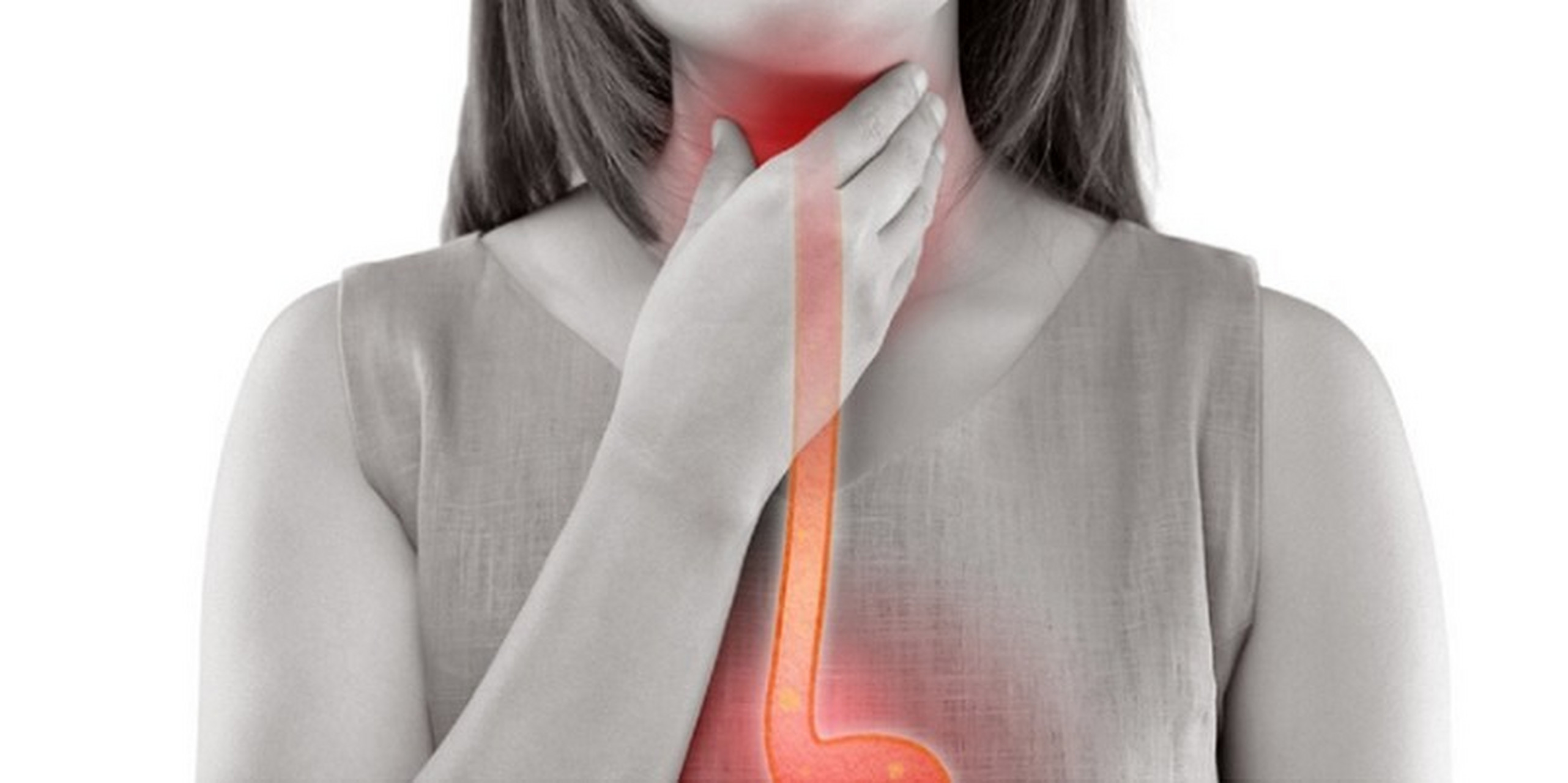 喉咙痛可能不是慢性咽炎,是胃反流73 早上睡醒经常觉得喉咙痛,痒痒
